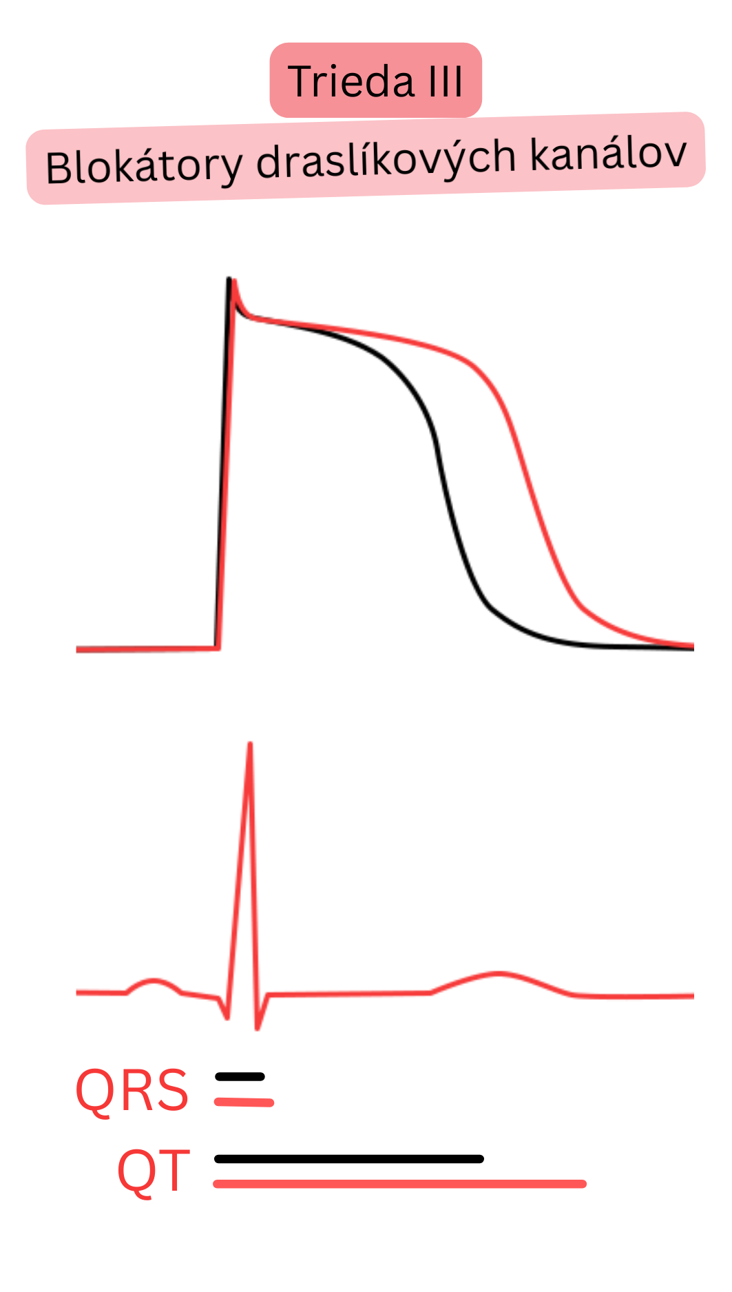 Schéma účinku antiarytmík triedy III – blokátorov draslíkových kanálov – znázorňujúca predĺženie repolarizácie akčného potenciálu a QT intervalu na EKG pri nezmenenej šírke QRS komplexu.