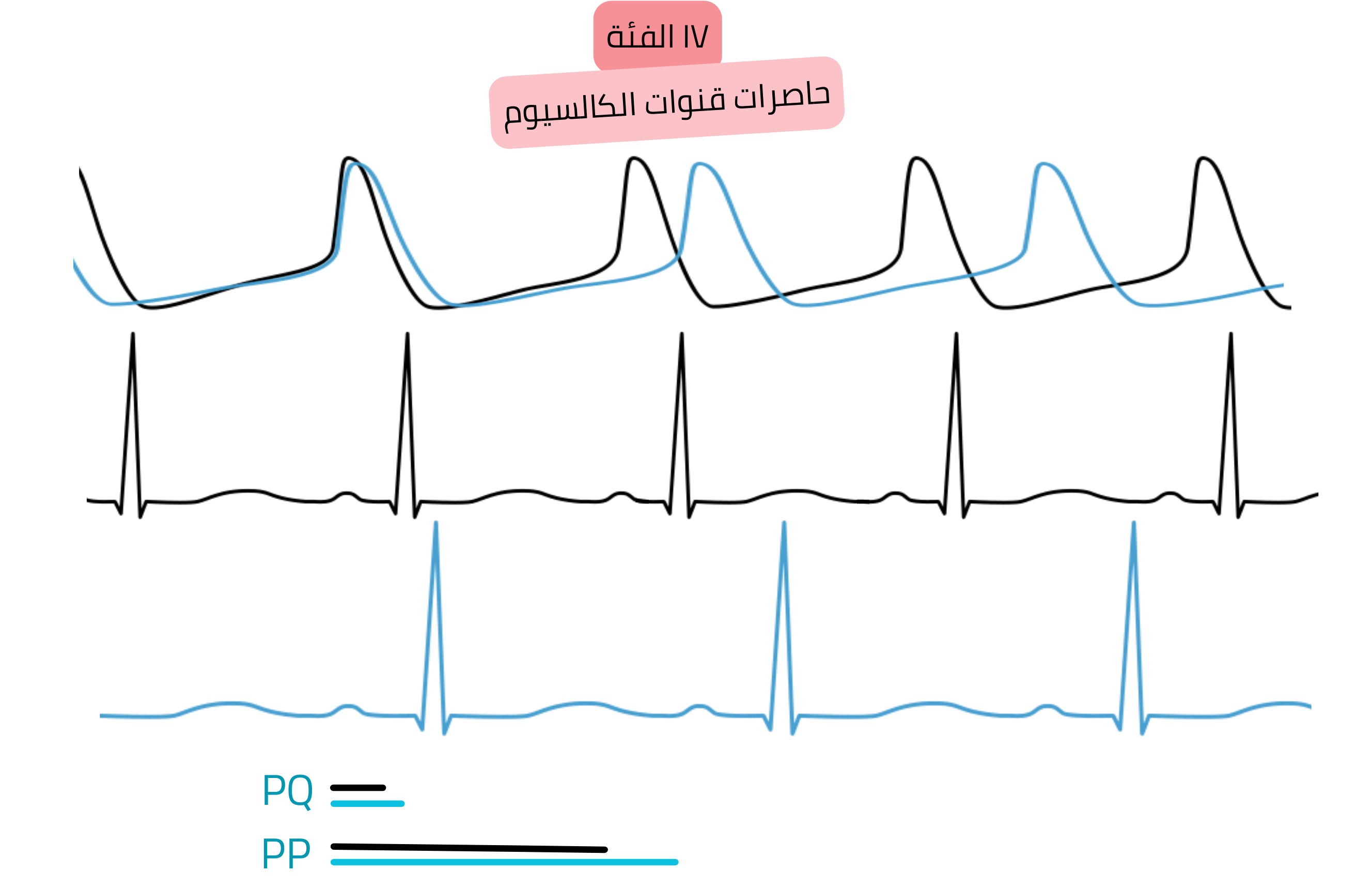 مخطط تأثير مضادات اضطراب النظم من الفئة IV — حاصرات قنوات الكالسيوم — يوضح تباطؤ التوصيل الأذيني البطيني مع إطالة فترة PQ وانخفاض معدل ضربات القلب على تخطيط القلب.