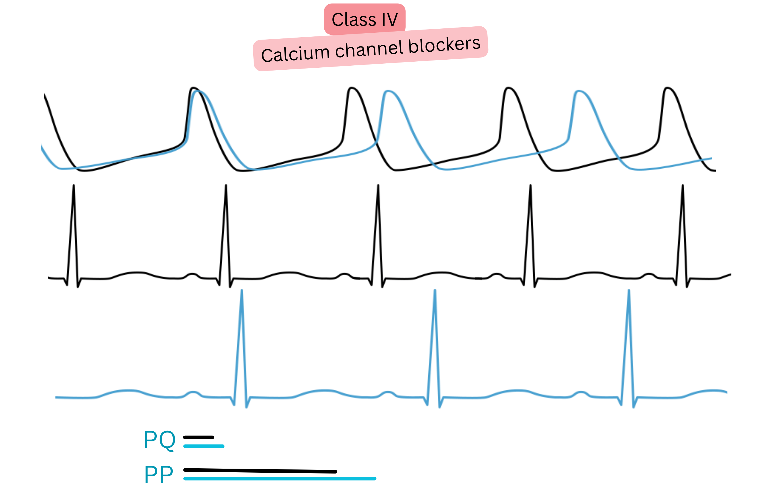 Diagram of the effect of class IV antiarrhythmic drugs—calcium channel blockers—illustrating slowed atrioventricular conduction with prolongation of the PQ interval and reduction of heart rate on ECG.