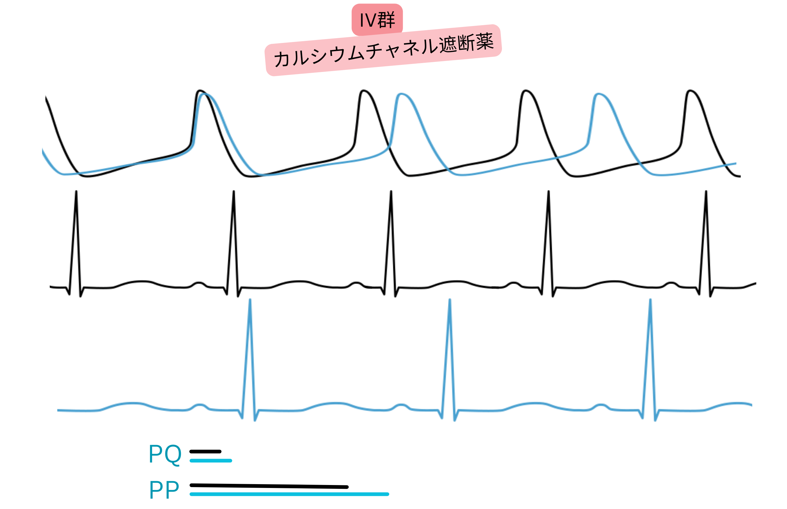 IV群抗不整脈薬であるカルシウムチャネル遮断薬の作用を示す模式図で、房室伝導の遅延、PQ間隔の延長および心拍数の低下を心電図上で示す。