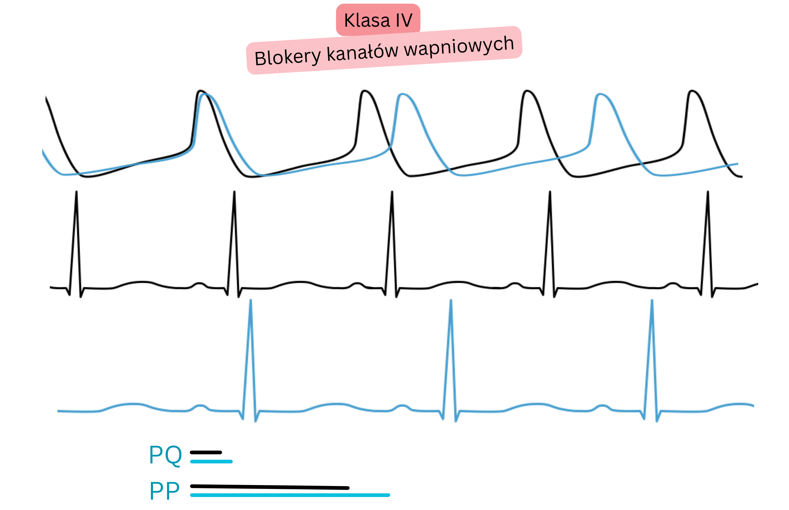 Schemat działania leków antyarytmicznych klasy IV — blokerów kanałów wapniowych — przedstawiający spowolnienie przewodzenia przedsionkowo-komorowego z wydłużeniem odstępu PQ oraz obniżeniem częstości serca w EKG.