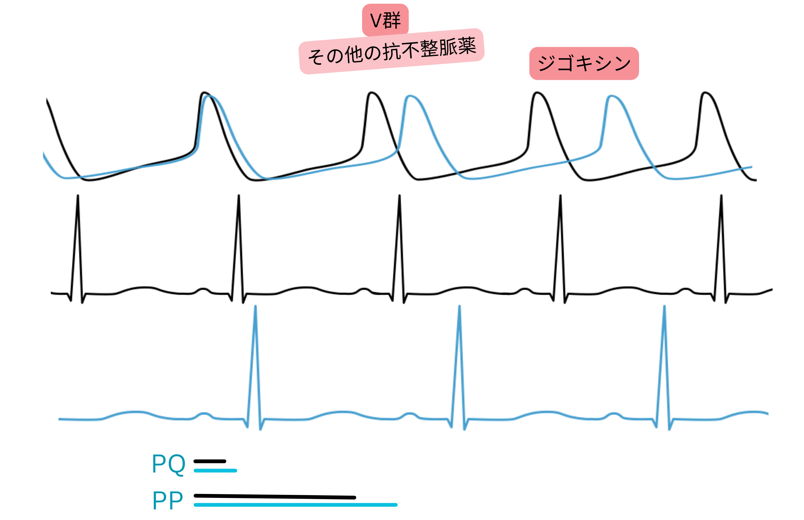 V群抗不整脈薬としてのジゴキシンの作用を示す模式図で、副交感神経活動の亢進によりPQ間隔が延長し、心拍数が低下することを示す。