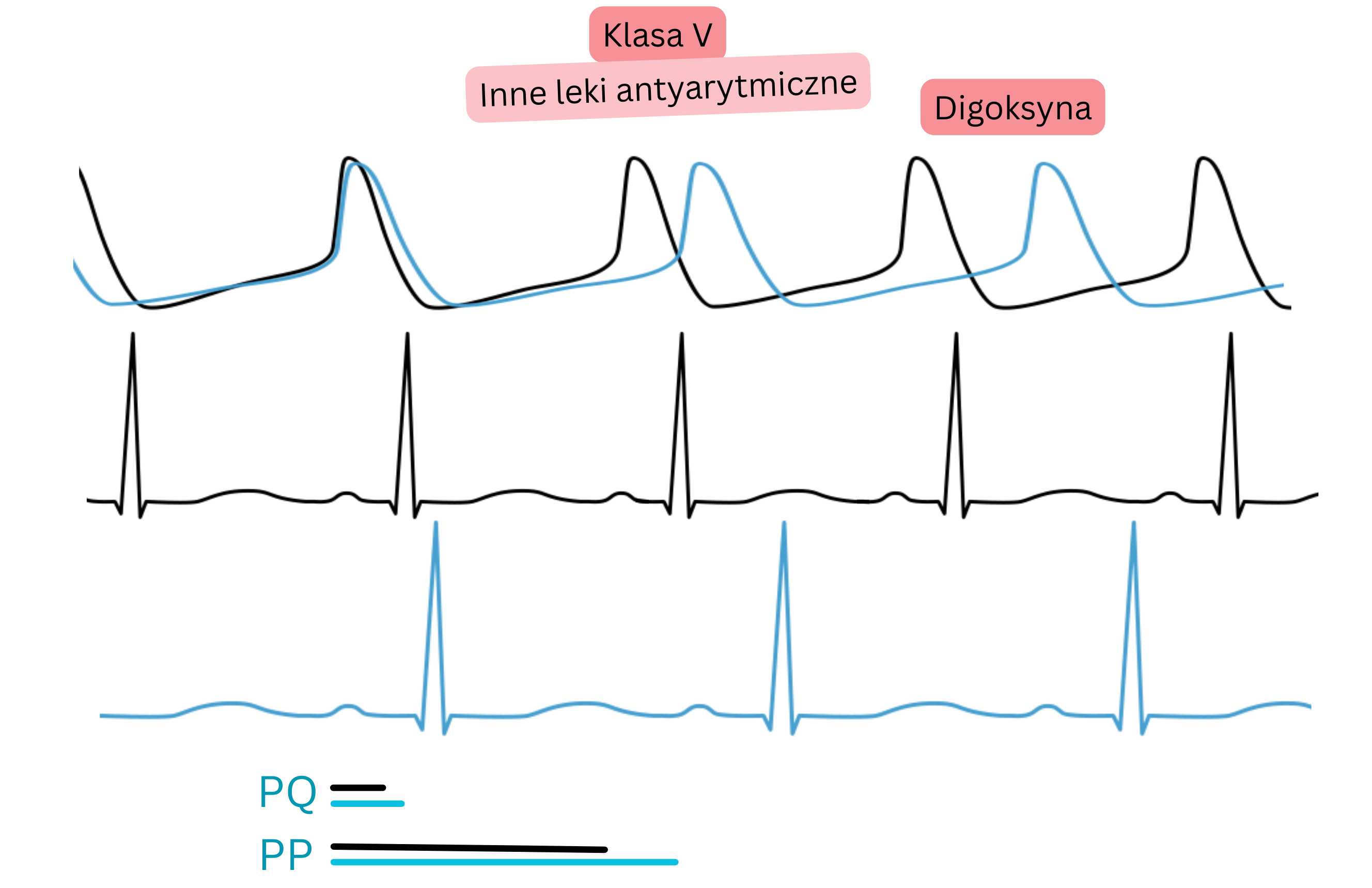 Schemat działania digoksyny jako leku antyarytmicznego klasy V, przedstawiający wzrost aktywności przywspółczulnej z wydłużeniem odstępu PQ i spowolnieniem częstości serca w EKG.
