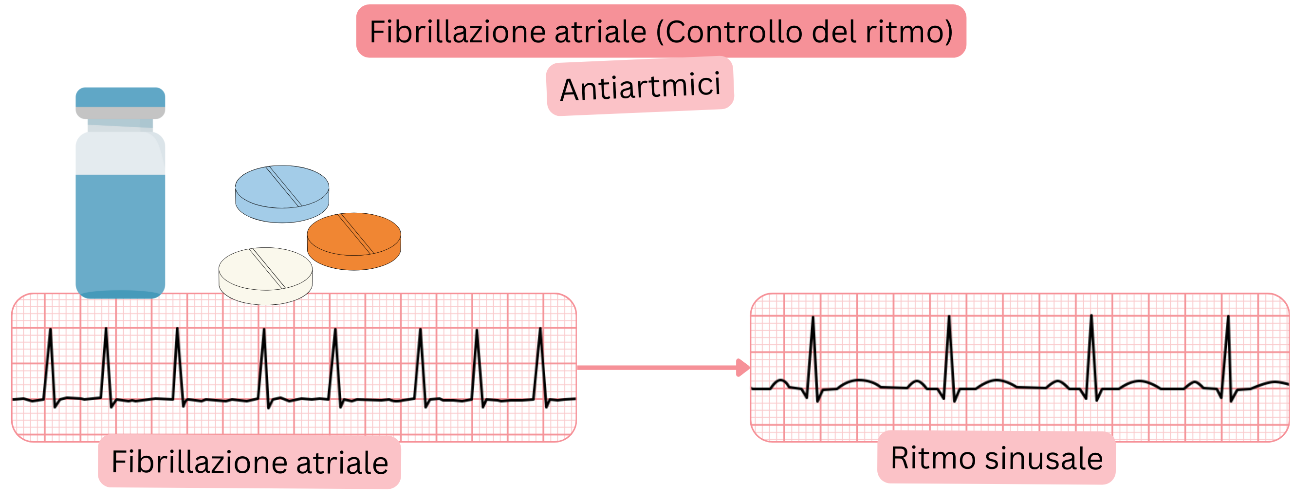 Schema di controllo del ritmo nella fibrillazione atriale con terapia antiaritmica che mostra il ripristino e il mantenimento del ritmo sinusale.