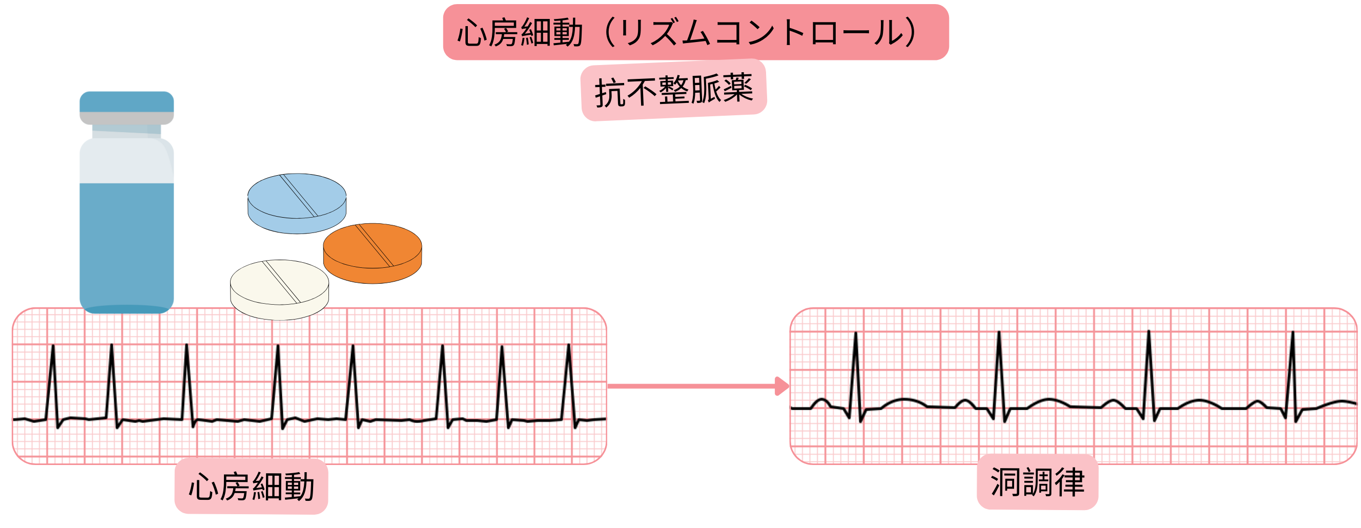 抗不整脈薬治療による心房細動のリズムコントロールを示し、洞調律の回復と維持を示した模式図。