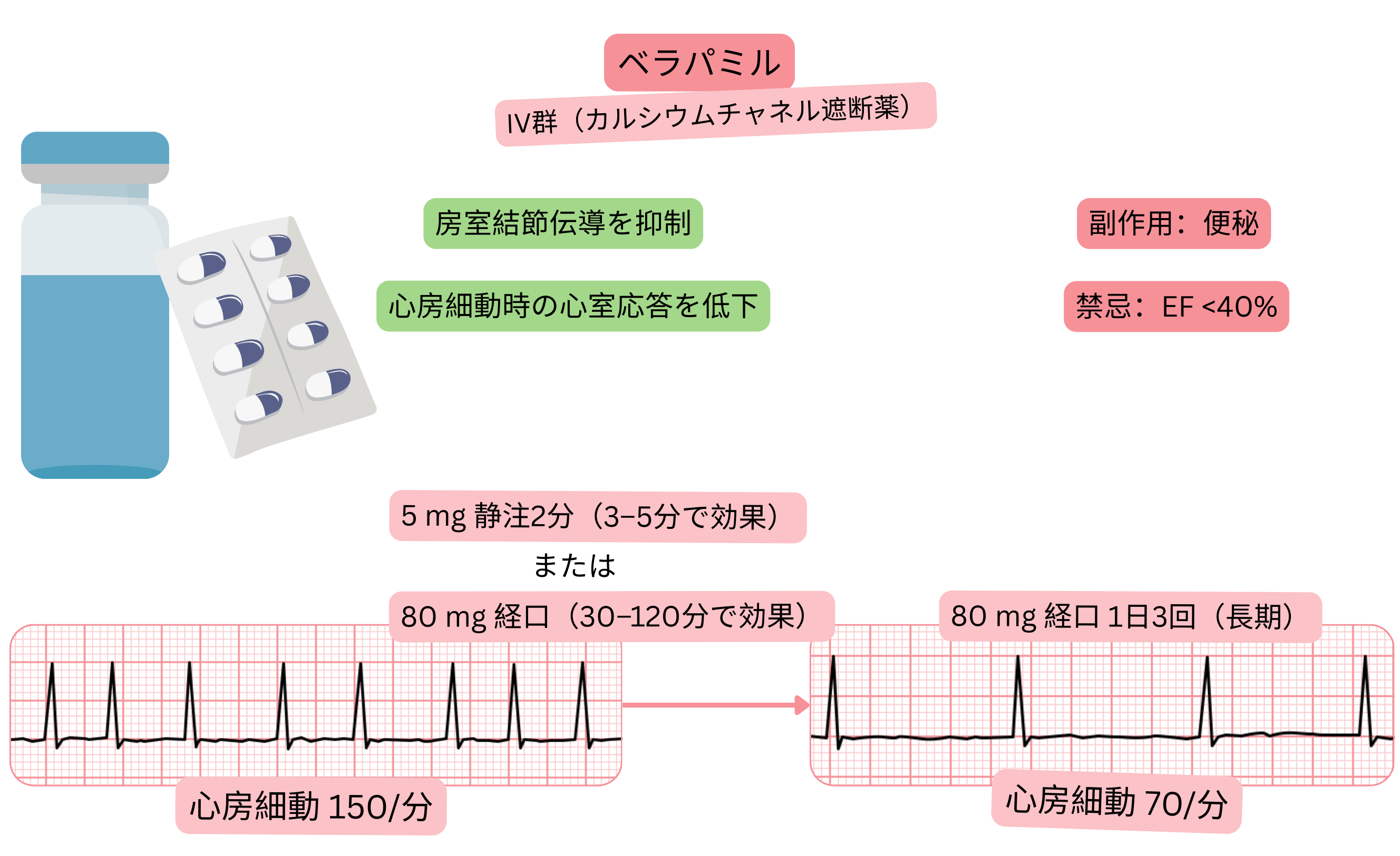 IV群抗不整脈薬としてのベラパミルの作用を示す模式図で、房室結節伝導の遅延と心房細動時の心室応答低下を示す。