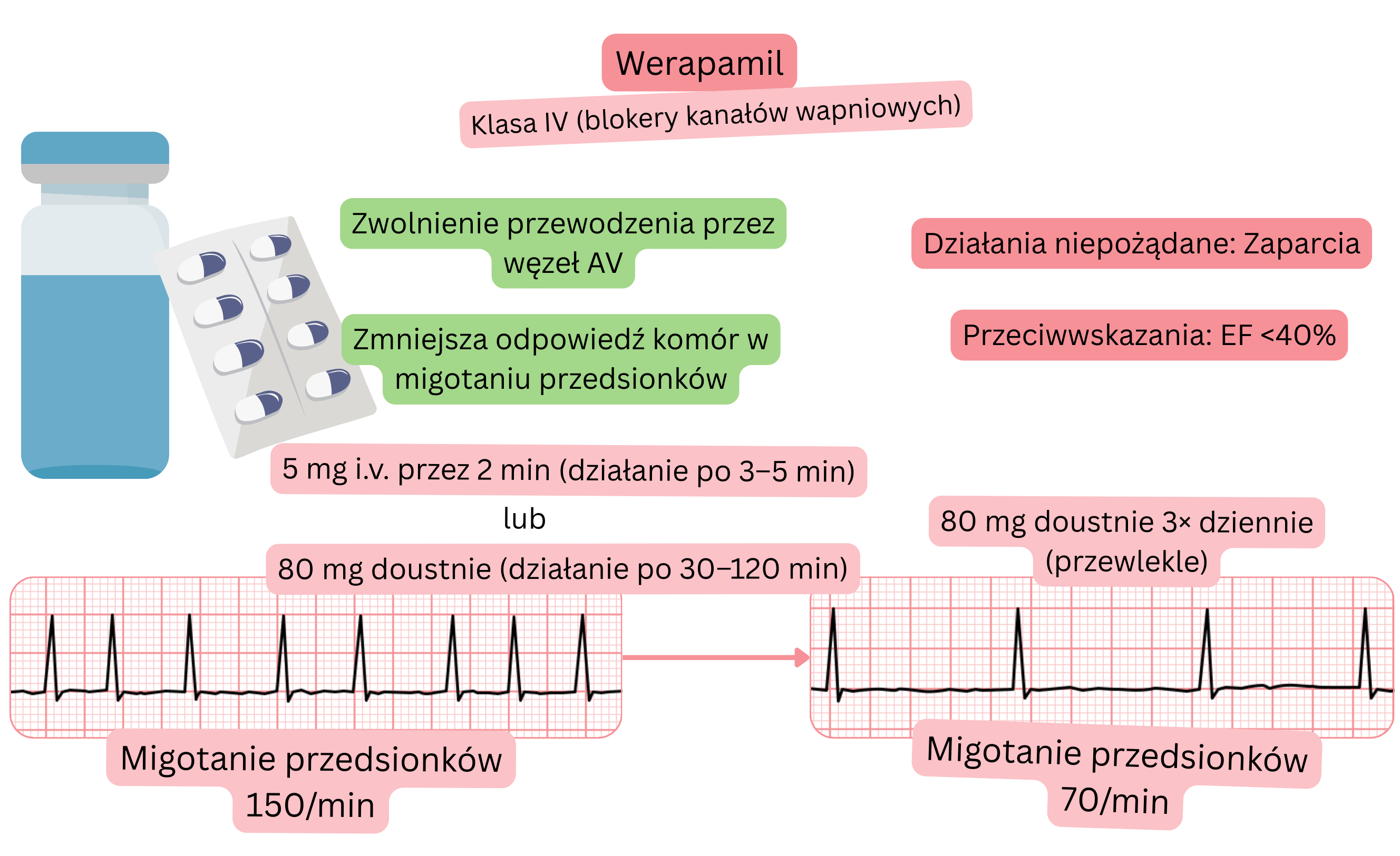 Schemat działania werapamilu jako leku antyarytmicznego klasy IV, przedstawiający spowolnienie przewodzenia przez węzeł przedsionkowo-komorowy oraz zmniejszenie odpowiedzi komorowej w migotaniu przedsionków.