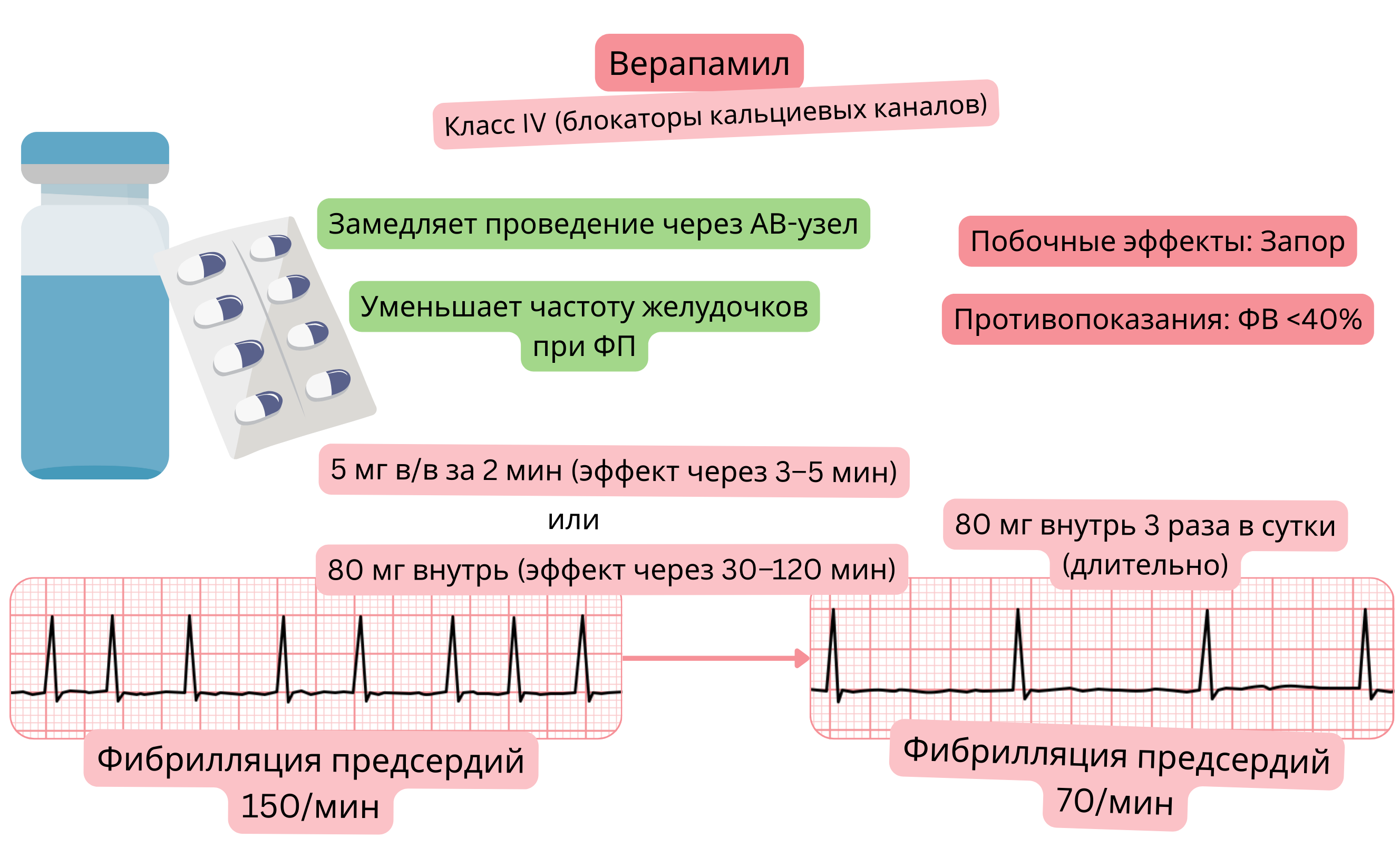 Схема действия верапамила как антиаритмического препарата класса IV, демонстрирующая замедление проведения через атриовентрикулярный узел и снижение желудочкового ответа при фибрилляции предсердий.