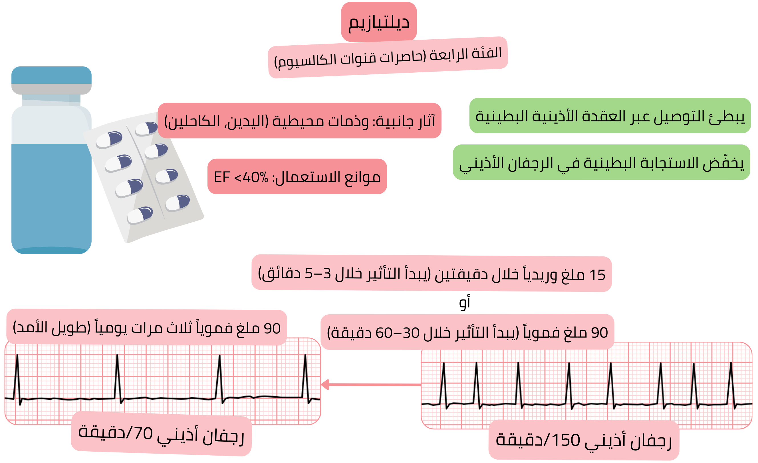 مخطط تأثير الديلتيازيم كمضاد اضطراب نظم من الفئة IV يوضح تباطؤ التوصيل عبر العقدة الأذينية البطينية وانخفاض معدل الاستجابة البطينية في الرجفان الأذيني.