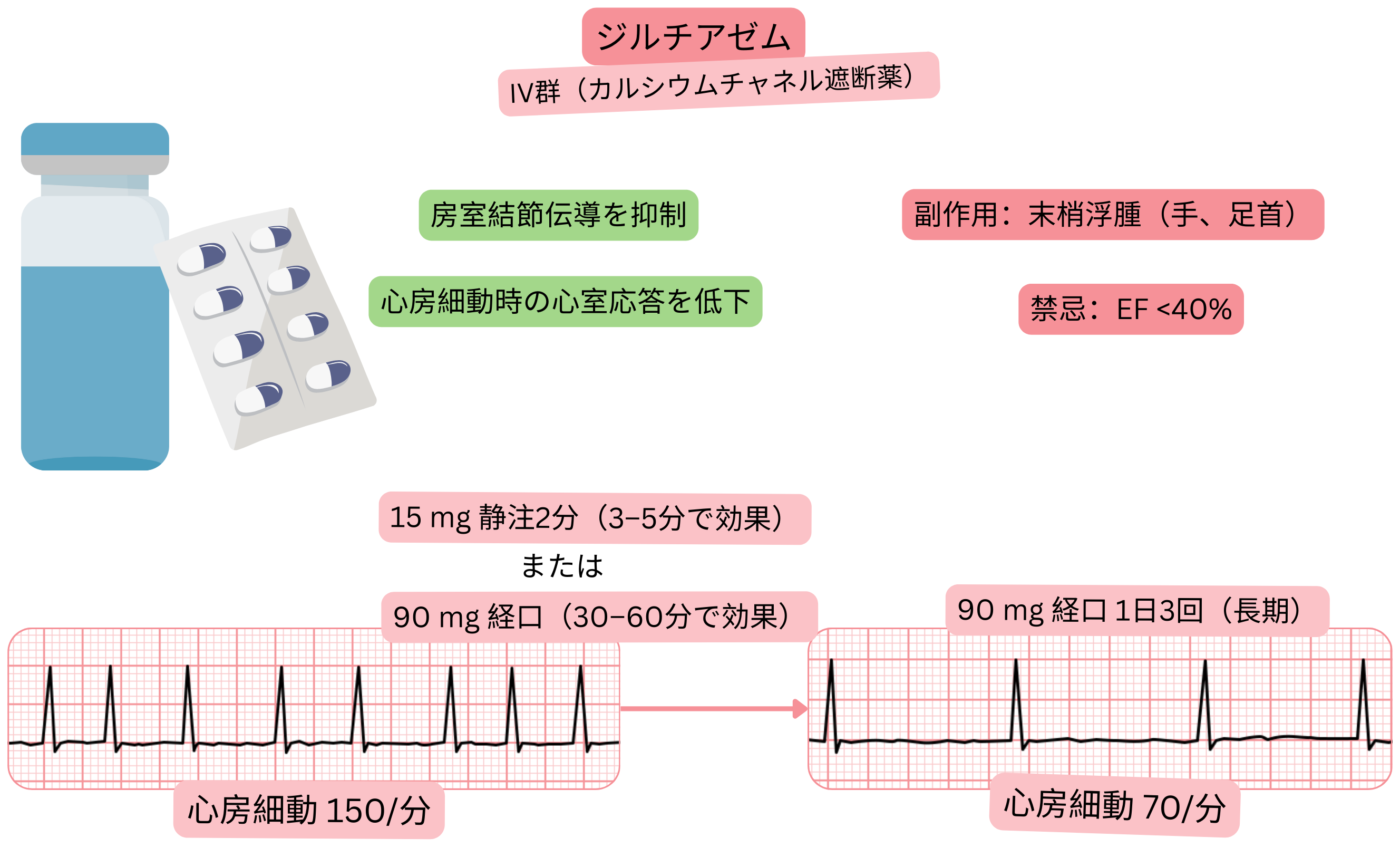 IV群抗不整脈薬としてのジルチアゼムの作用を示す模式図で、房室結節伝導の遅延と心房細動時の心室拍数低下を示す。