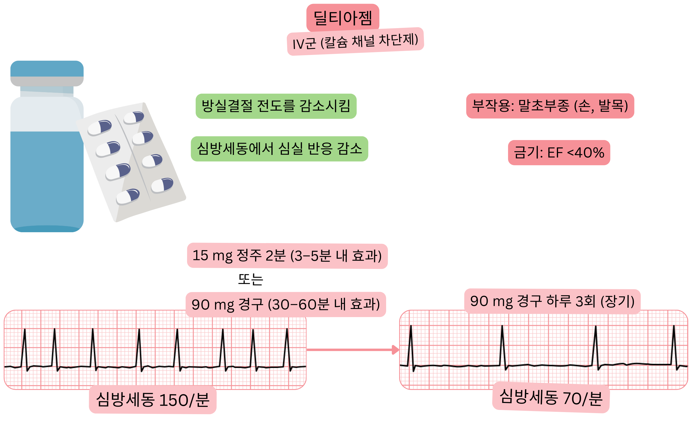IV군 항부정맥제로서 딜티아젬의 효과를 나타낸 도식으로, 방실결절 전도 지연과 심방세동에서 심실 빈도 감소를 보여준다.