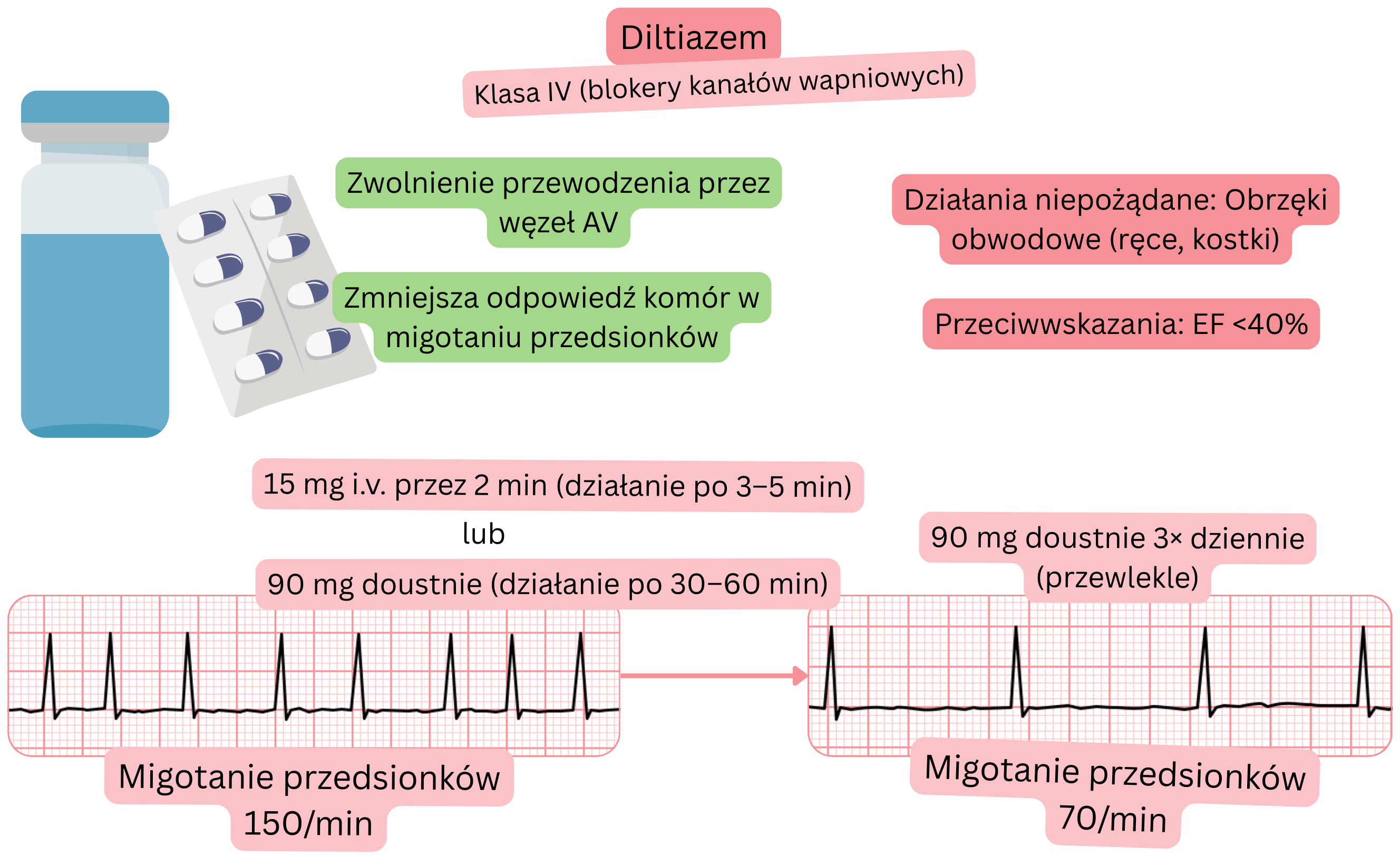 Schemat działania diltiazemu jako leku antyarytmicznego klasy IV, przedstawiający spowolnienie przewodzenia przez węzeł przedsionkowo-komorowy oraz zmniejszenie częstości komorowej w migotaniu przedsionków.