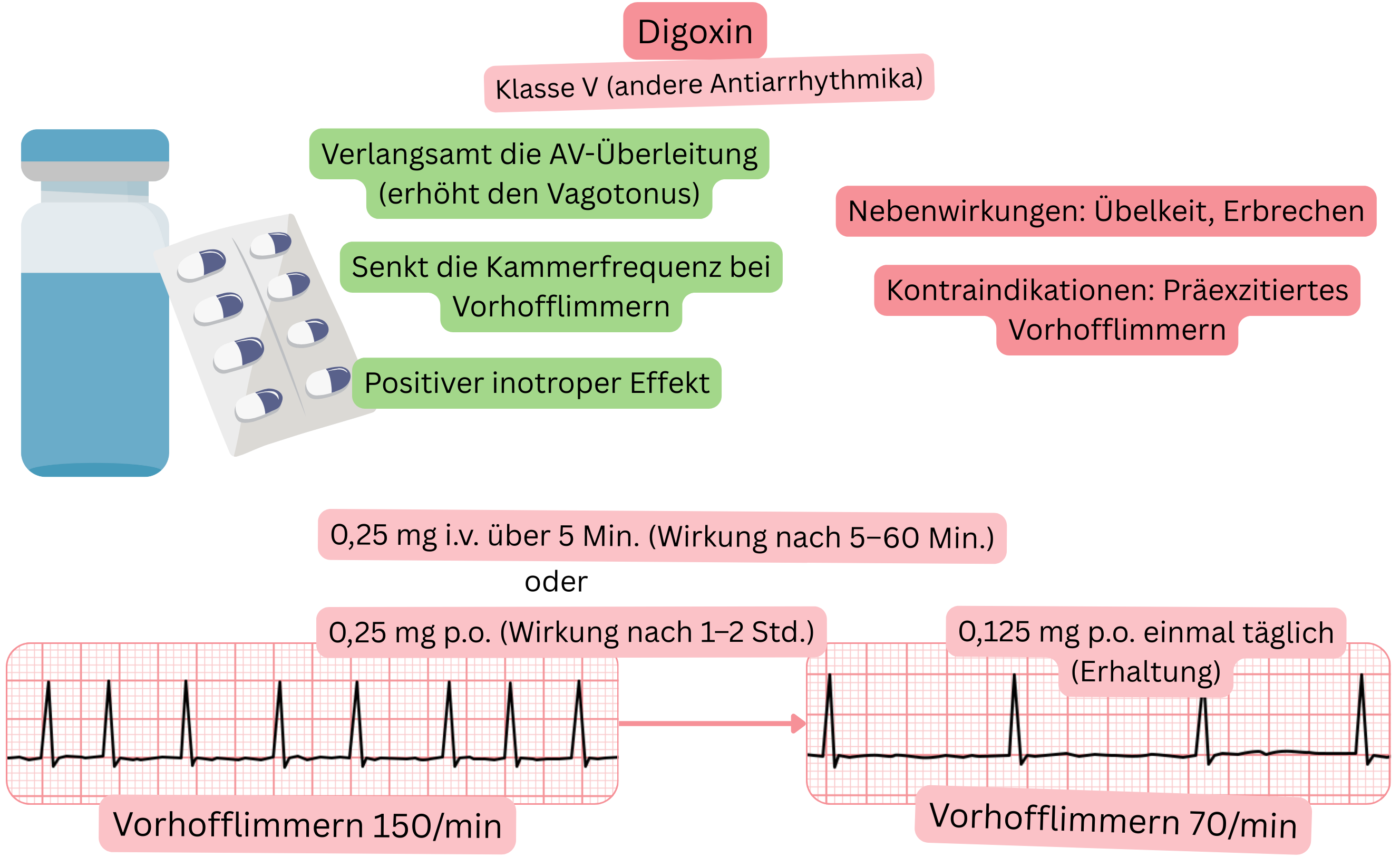 Schema der Wirkung von Digoxin als Antiarrhythmikum der Klasse V mit Darstellung der vagal vermittelten Verlangsamung der AV-Knoten-Überleitung, Reduktion der ventrikulären Antwort bei Vorhofflimmern und positivem inotropem Effekt.