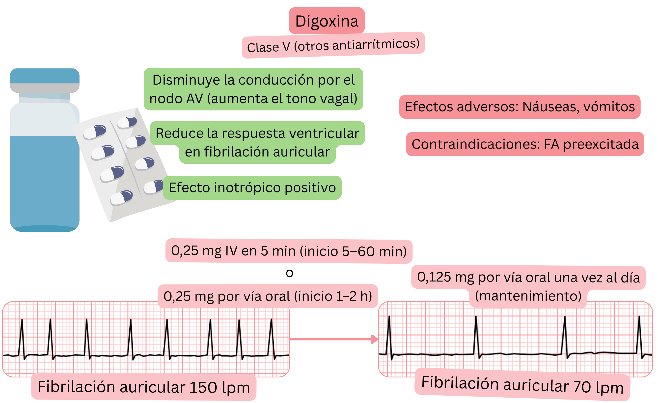Esquema del efecto de la digoxina como antiarrítmico de clase V que muestra el enlentecimiento vagal de la conducción a través del nodo auriculoventricular, la reducción de la respuesta ventricular en la fibrilación auricular y el efecto inotrópico positivo.