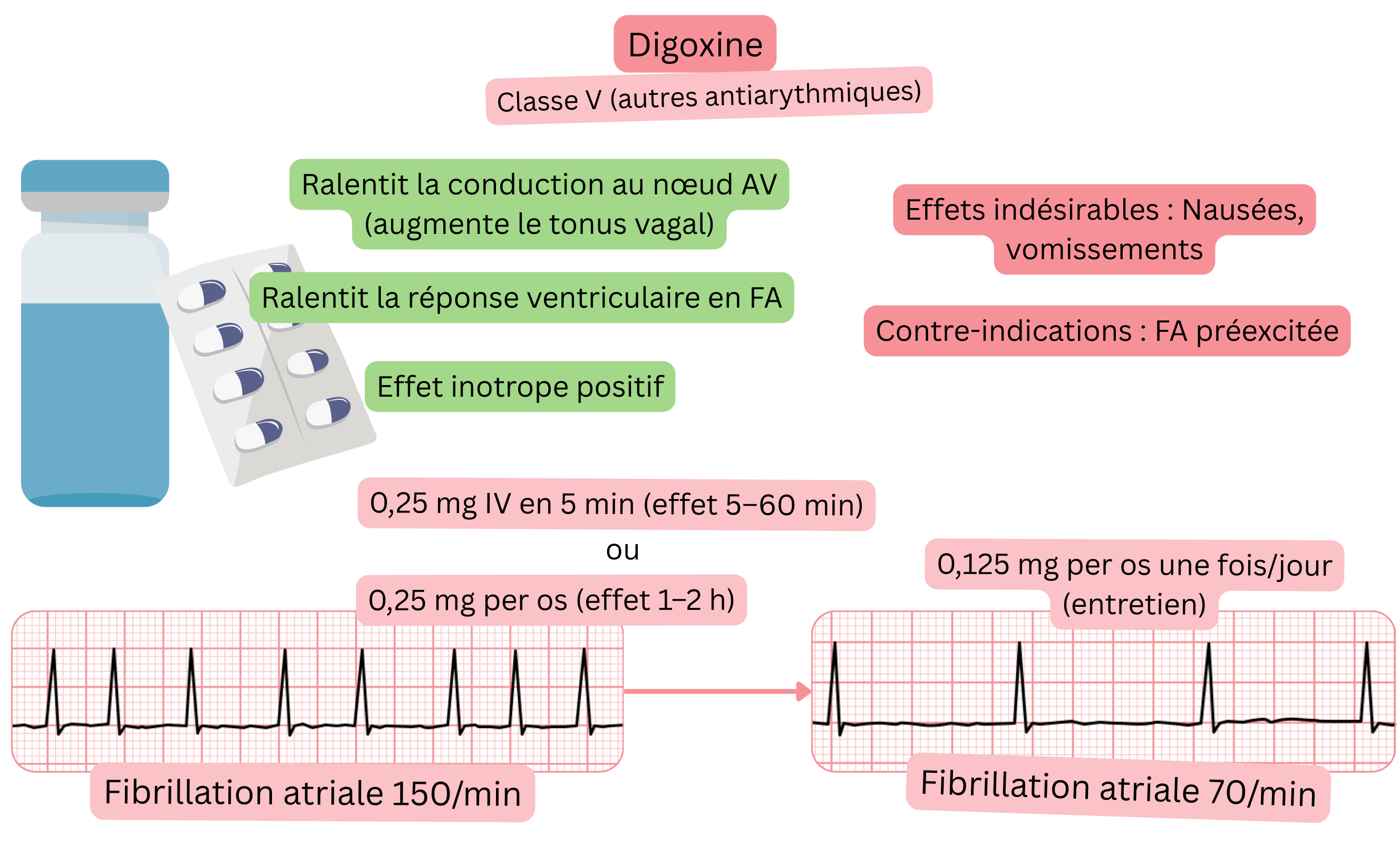 Schéma de l’effet de la digoxine comme antiarythmique de classe V illustrant le ralentissement vagal de la conduction au niveau du nœud auriculoventriculaire, la diminution de la réponse ventriculaire en fibrillation auriculaire et l’effet inotrope positif.