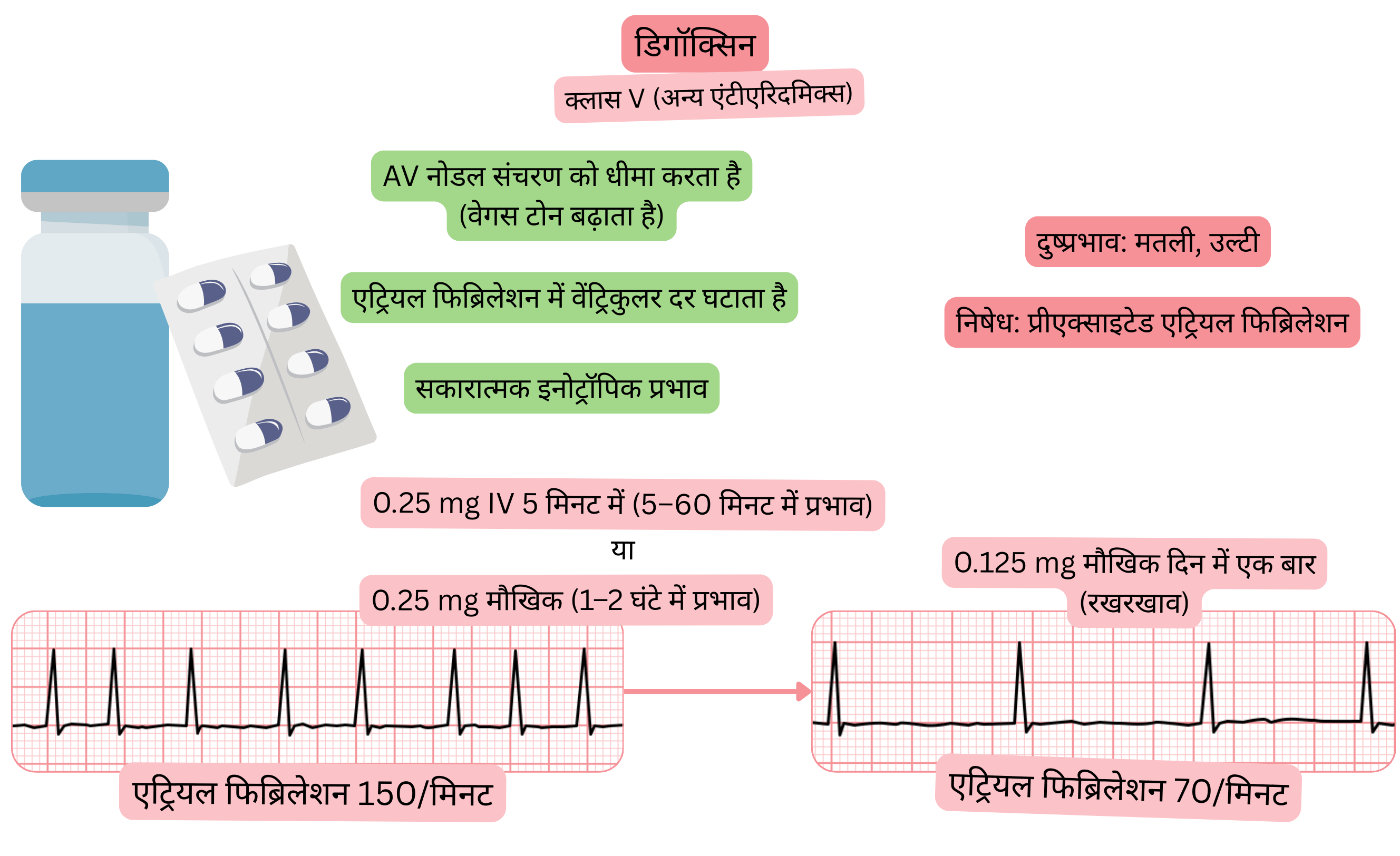 क्लास V एंटीएरिदमिक के रूप में डिगॉक्सिन के प्रभाव का आरेख, जिसमें वेगस-जनित एट्रियोवेंट्रिकुलर नोडल कंडक्शन का धीमा होना, एट्रियल फिब्रिलेशन में वेंट्रिकुलर प्रतिक्रिया में कमी तथा सकारात्मक इनोट्रोपिक प्रभाव दर्शाया गया है।