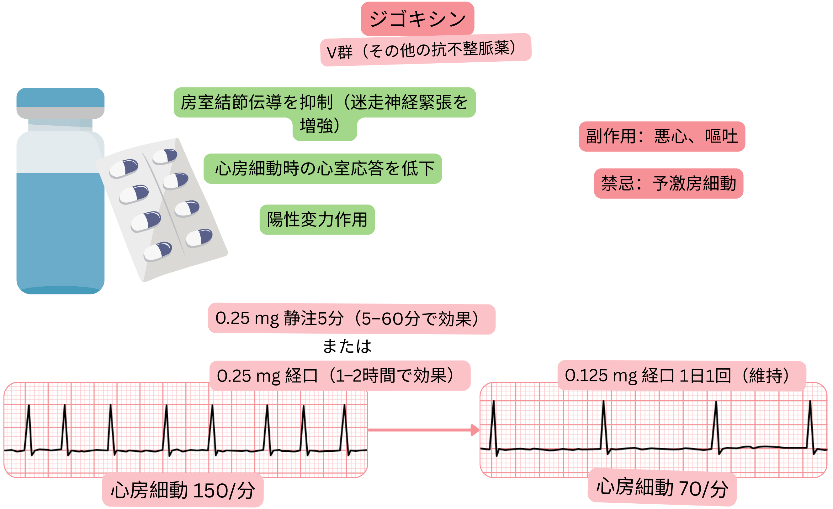 V群抗不整脈薬としてのジゴキシンの作用を示す模式図で、迷走神経介在性の房室結節伝導遅延、心房細動時の心室応答低下、および陽性変力作用を示す。
