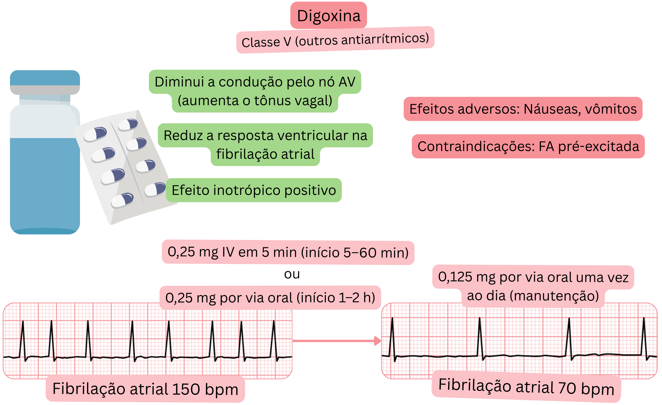 Esquema do efeito da digoxina como antiarrítmico de classe V demonstrando lentificação vagal da condução pelo nó atrioventricular, redução da resposta ventricular na fibrilação atrial e efeito inotrópico positivo.