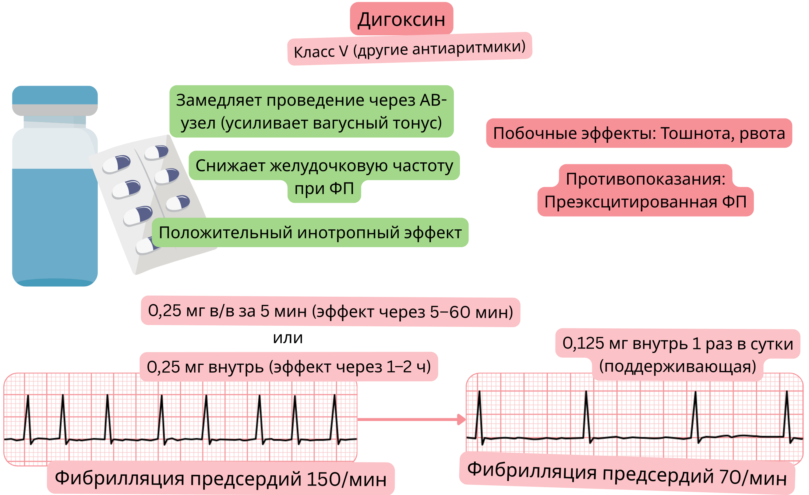 Схема действия дигоксина как антиаритмического препарата класса V, демонстрирующая вагус-опосредованное замедление проведения через атриовентрикулярный узел, снижение желудочкового ответа при фибрилляции предсердий и положительный инотропный эффект.