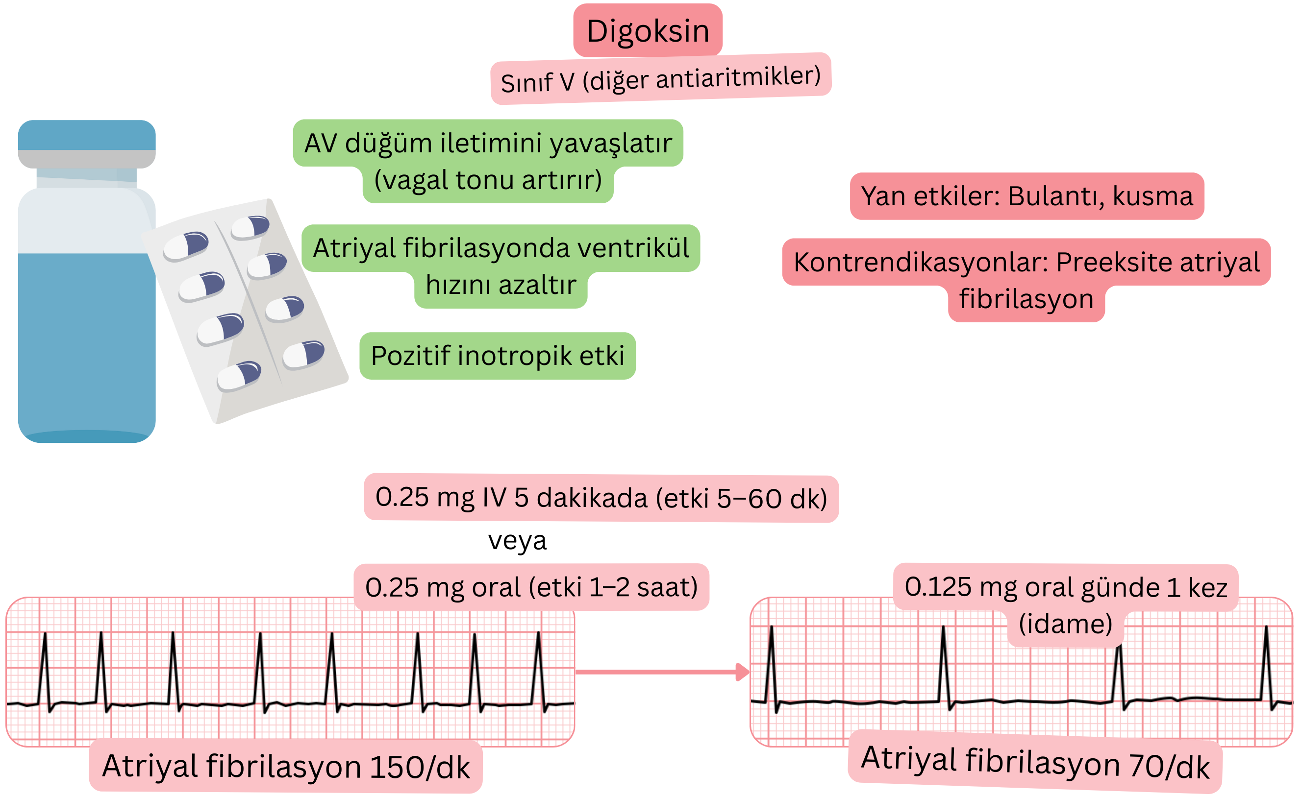 V sınıfı antiaritmik olarak digoksinin etkisini gösteren şema; vagal aracılı AV düğüm iletiminin yavaşlamasını, atriyal fibrilasyonda ventriküler yanıtın azalmasını ve pozitif inotropik etkiyi göstermektedir.