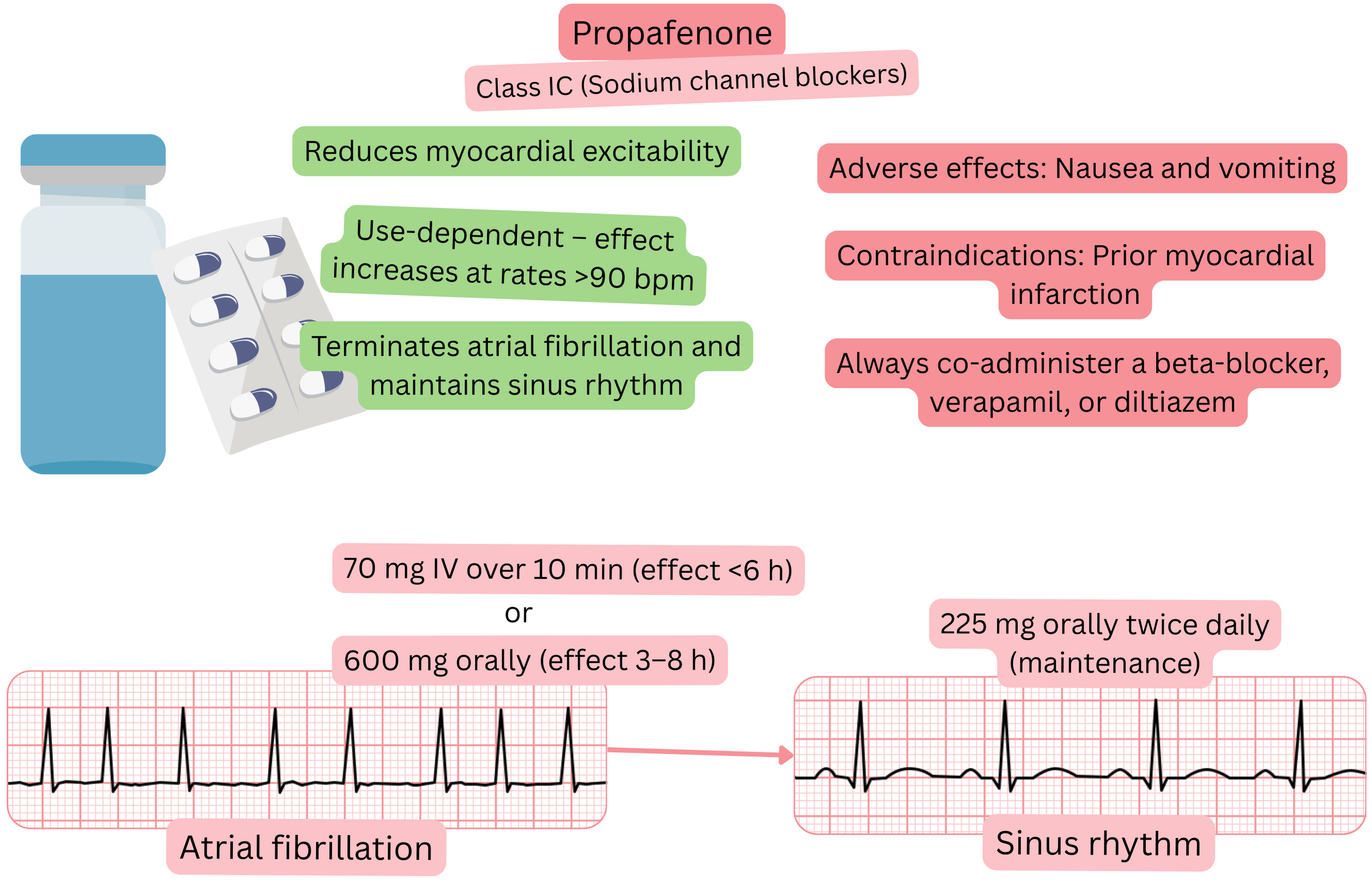 Diagram of the effect of propafenone as a class IC antiarrhythmic illustrating use-dependent sodium channel blockade, reduced myocardial excitability, and pharmacological cardioversion of atrial fibrillation to sinus rhythm.