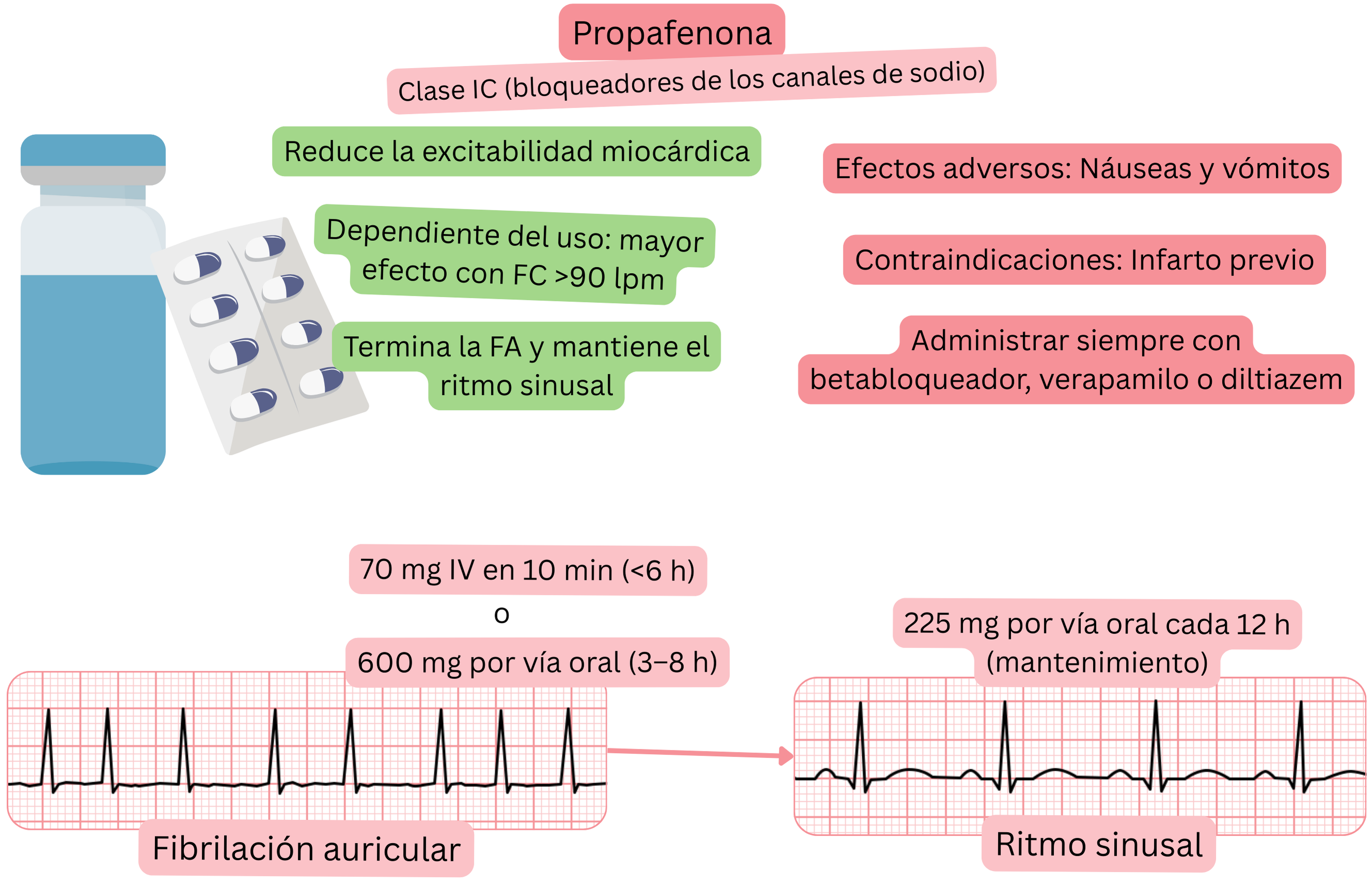 Esquema del efecto de la propafenona como antiarrítmico de clase IC que muestra el bloqueo de los canales de sodio dependiente del uso, la reducción de la excitabilidad miocárdica y la cardioversión farmacológica de la fibrilación auricular a ritmo sinusal.