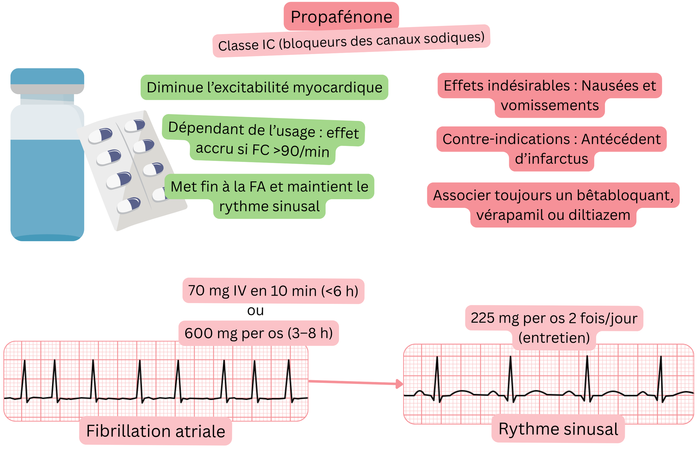 Schéma de l’effet de la propafénone comme antiarythmique de classe IC illustrant le blocage des canaux sodiques dépendant de l’usage, la diminution de l’excitabilité myocardique et la cardioversion pharmacologique de la fibrillation auriculaire en rythme sinusal.