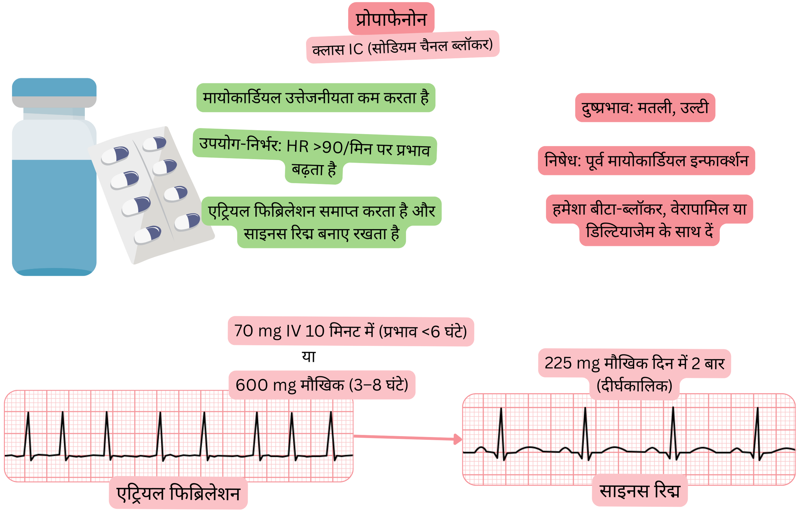 क्लास IC एंटीएरिदमिक के रूप में प्रोपाफेनोन के प्रभाव का आरेख, जिसमें उपयोग-निर्भर सोडियम चैनल ब्लॉकेड, मायोकार्डियल उत्तेजनीयता में कमी और एट्रियल फिब्रिलेशन की औषधीय कार्डियोवर्ज़न द्वारा साइनस रिद्म की बहाली दर्शाई गई है।