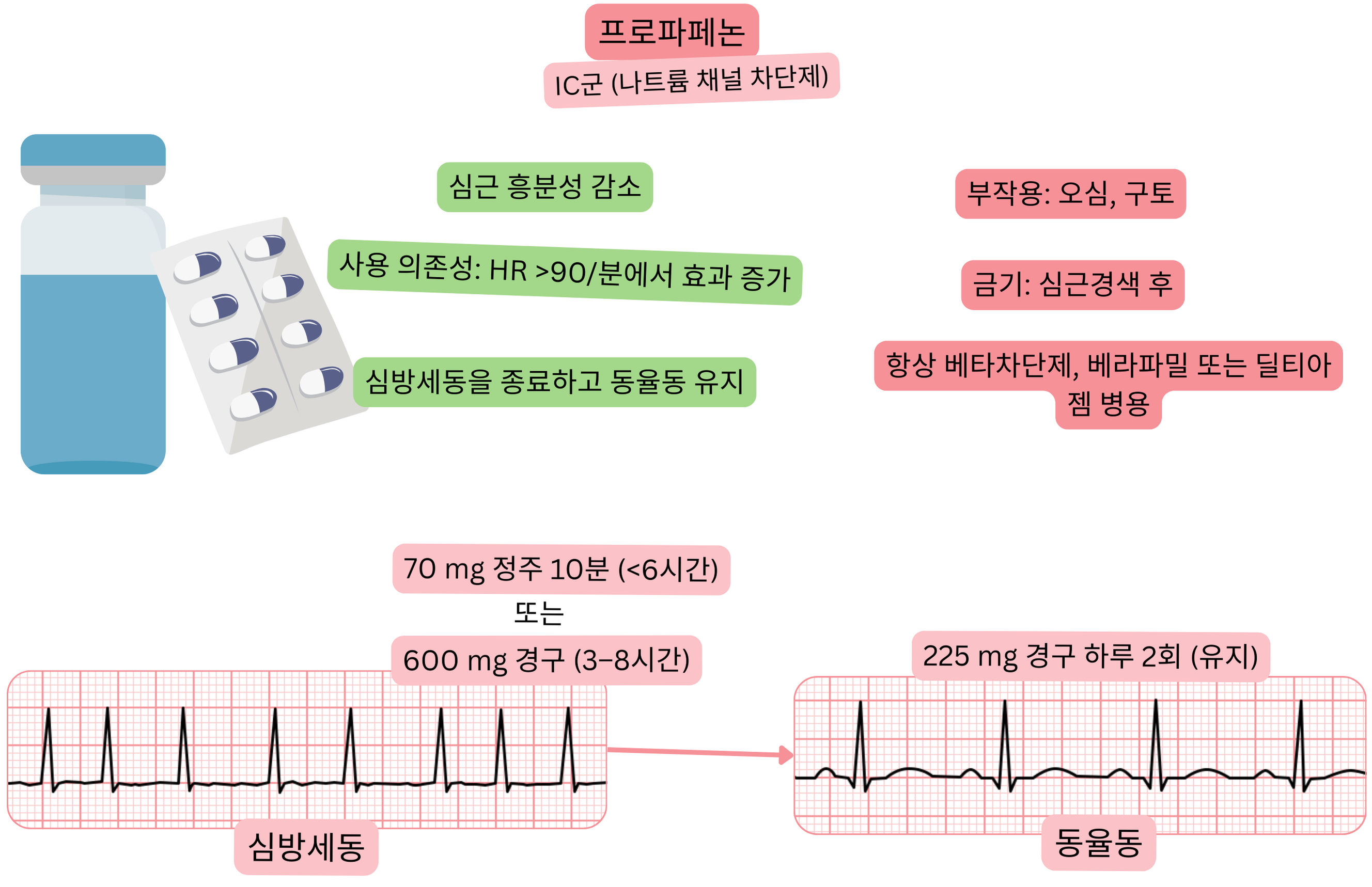 IC군 항부정맥제로서 프로파페논의 효과를 나타낸 도식으로, 사용 의존적 나트륨 채널 차단, 심근 흥분성 감소 및 심방세동의 약물적 동율동 전환을 보여준다.