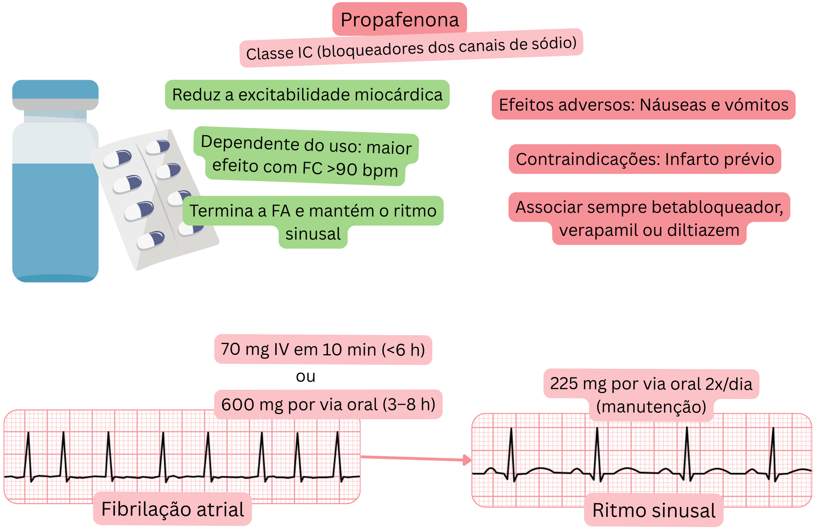 Esquema do efeito da propafenona como antiarrítmico de classe IC demonstrando bloqueio dos canais de sódio dependente do uso, redução da excitabilidade miocárdica e cardioversão farmacológica da fibrilação atrial para ritmo sinusal.