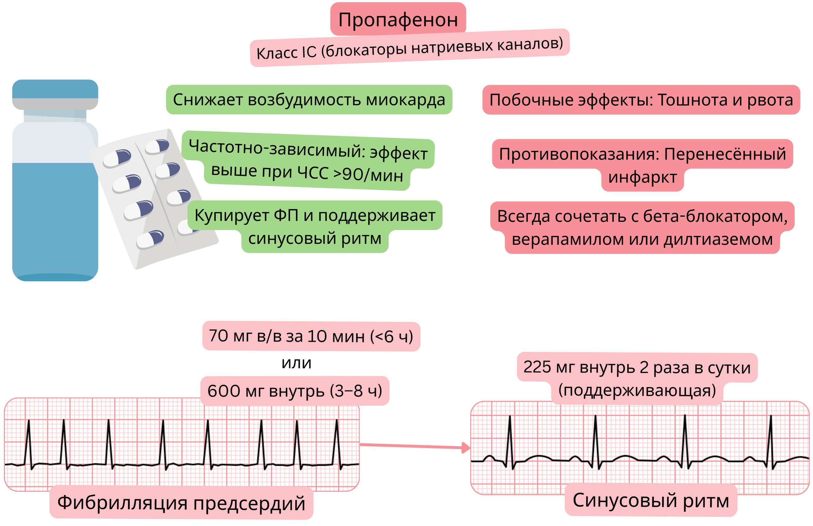 Схема действия пропафенона как антиаритмического препарата класса IC, демонстрирующая зависимую от частоты блокаду натриевых каналов, снижение возбудимости миокарда и фармакологическую кардиоверсию фибрилляции предсердий в синусовый ритм.
