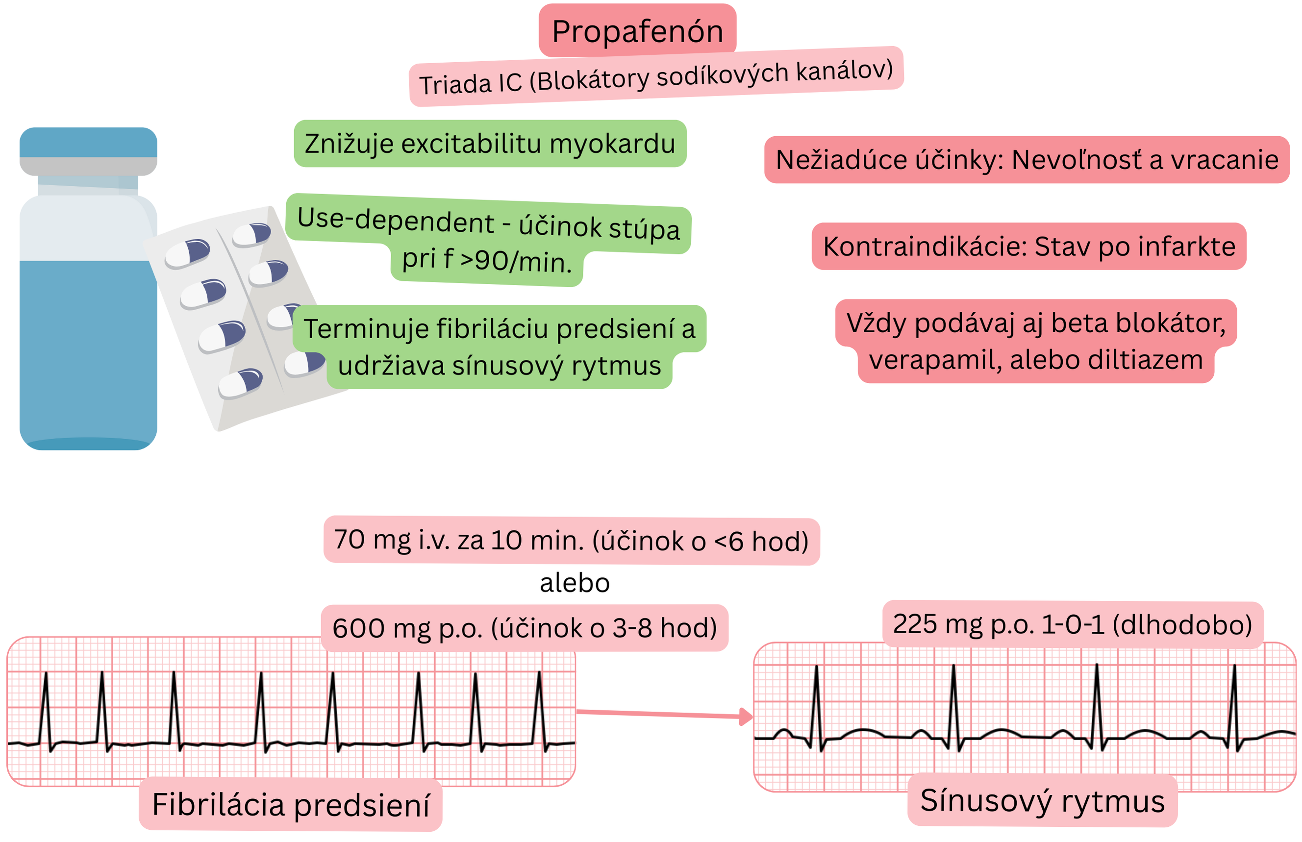 Schéma účinku propafenónu ako antiarytmika triedy IC znázorňujúca use-dependent blokádu sodíkových kanálov, zníženie excitability myokardu a farmakologickú kardioverziu fibrilácie predsiení na sínusový rytmus.