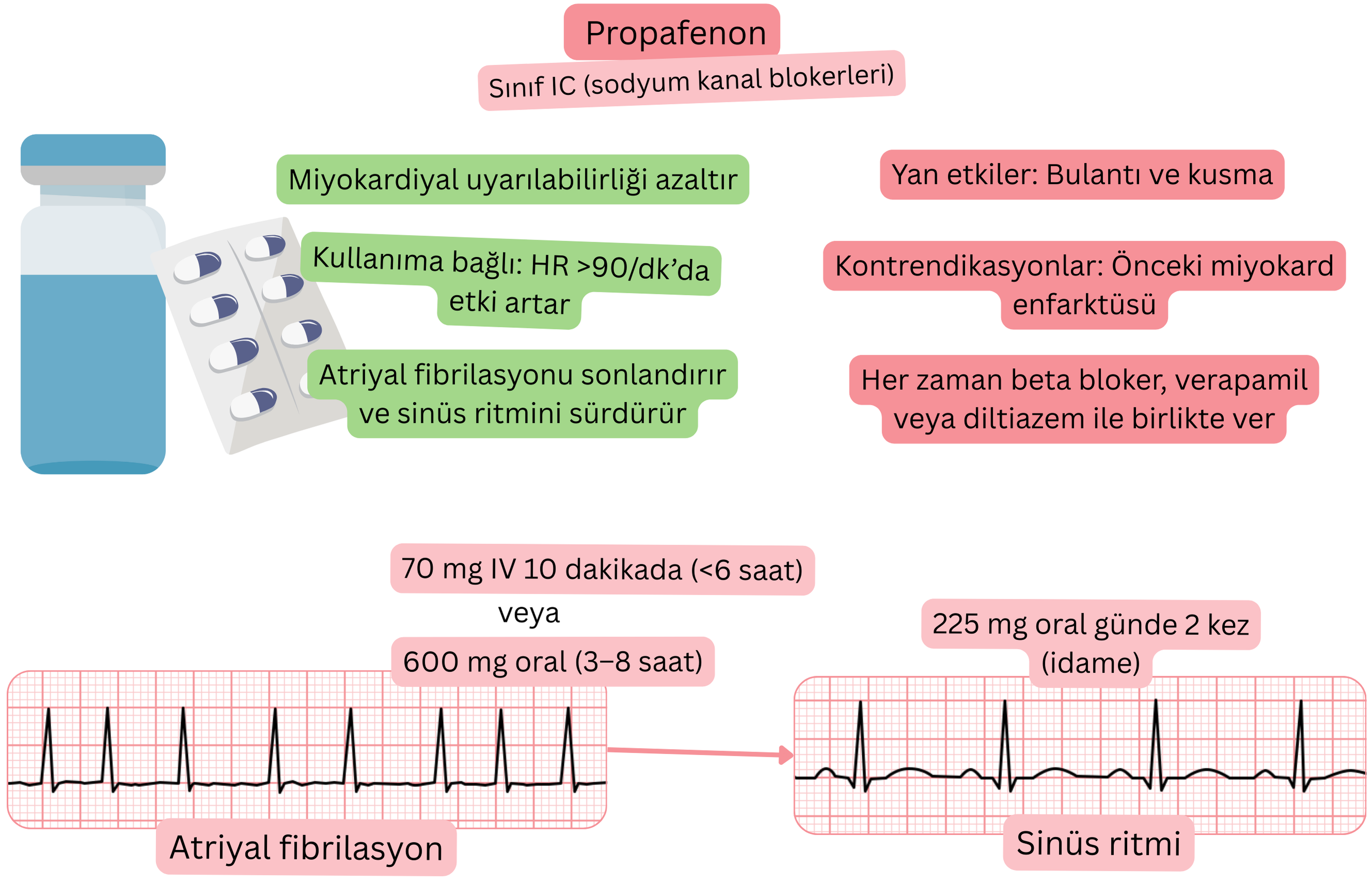 IC sınıfı antiaritmik olarak propafenonun etkisini gösteren şema; use-dependent sodyum kanal blokajını, miyokard uyarılabilirliğinin azalmasını ve atriyal fibrilasyonun farmakolojik olarak sinüs ritmine kardiyoversiyonunu göstermektedir.