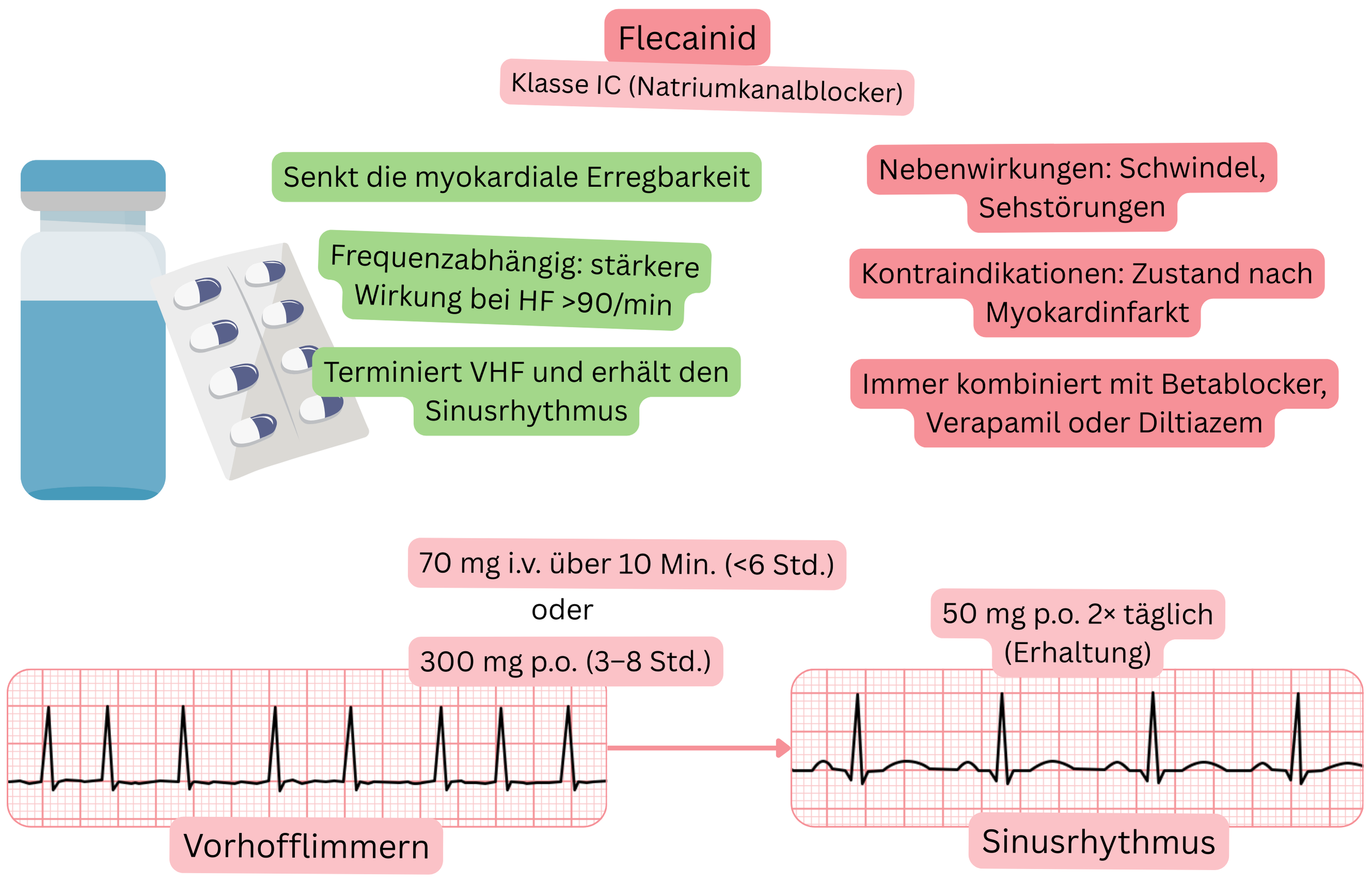 Schema der Wirkung von Flecainid als Antiarrhythmikum der Klasse IC mit Darstellung der use-abhängigen Blockade von Natriumkanälen, der Reduktion der myokardialen Erregbarkeit und der pharmakologischen Kardioversion von Vorhofflimmern in den Sinusrhythmus.