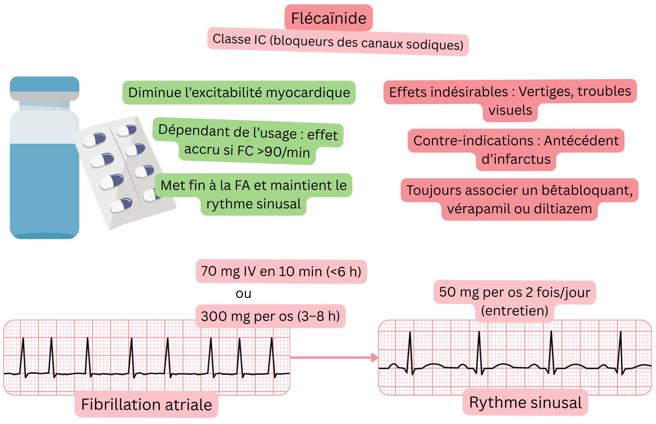 Schéma de l’effet de la flécaïnide comme antiarythmique de classe IC illustrant le blocage des canaux sodiques dépendant de l’usage, la diminution de l’excitabilité myocardique et la cardioversion pharmacologique de la fibrillation auriculaire en rythme sinusal.