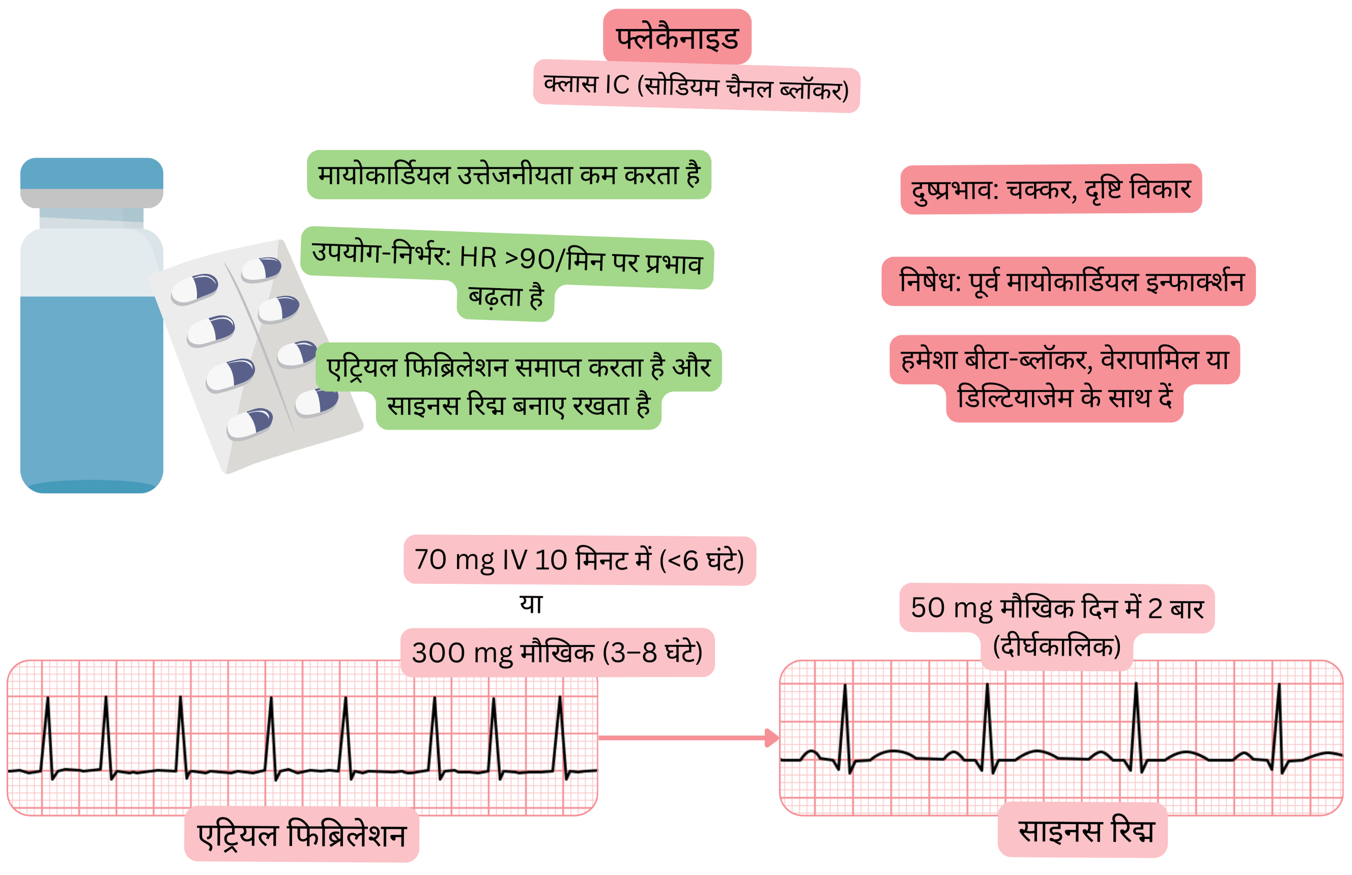 क्लास IC एंटीएरिदमिक के रूप में फ्लेकैनाइड के प्रभाव का आरेख, जिसमें उपयोग-निर्भर सोडियम चैनल ब्लॉकेड, मायोकार्डियल उत्तेजनीयता में कमी और एट्रियल फिब्रिलेशन की औषधीय कार्डियोवर्ज़न द्वारा साइनस रिद्म की बहाली दर्शाई गई है।