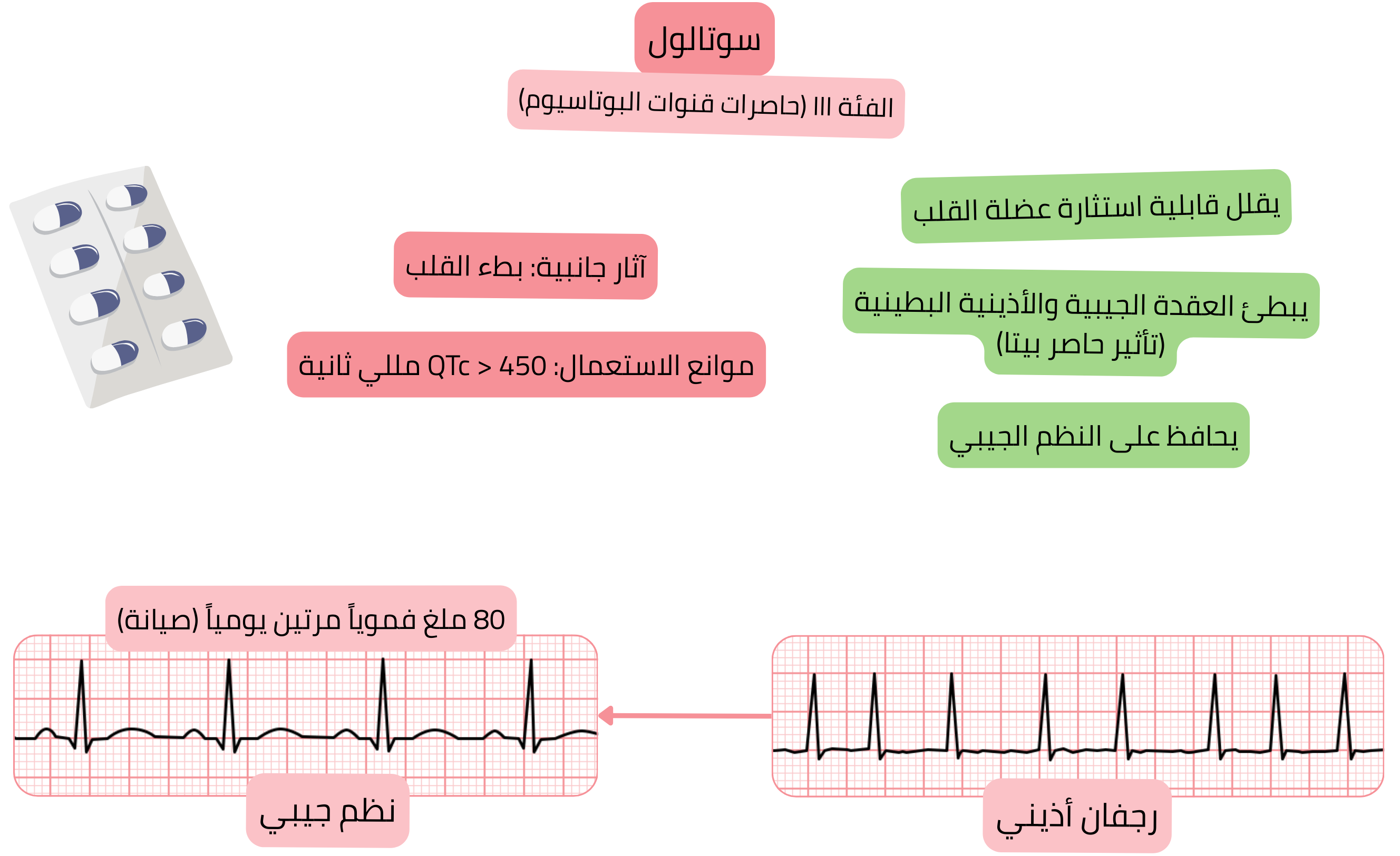 مخطط تأثير السوتالول كمضاد اضطراب نظم من الفئة III يوضح حصر قنوات البوتاسيوم مع إبطاء العقدة الجيبية والعقدة الأذينية البطينية، وانخفاض قابلية استثارة عضلة القلب، والحفاظ على النظم الجيبي في الرجفان الأذيني.