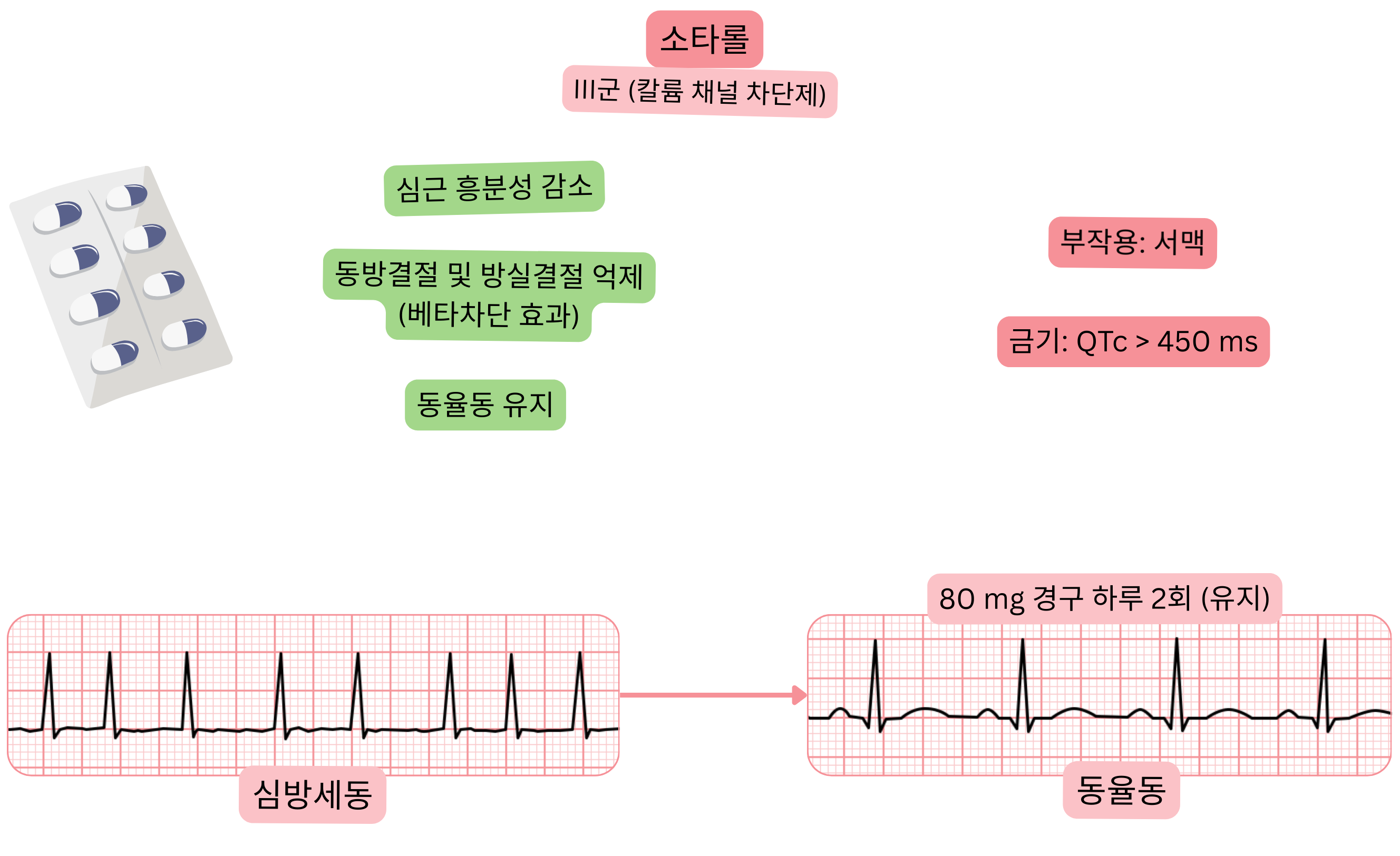 III군 항부정맥제로서 소타롤의 효과를 나타낸 도식으로, 칼륨 채널 차단에 따른 동결절 및 방실결절 억제, 심근 흥분성 감소 및 심방세동에서 동율동 유지를 보여준다.