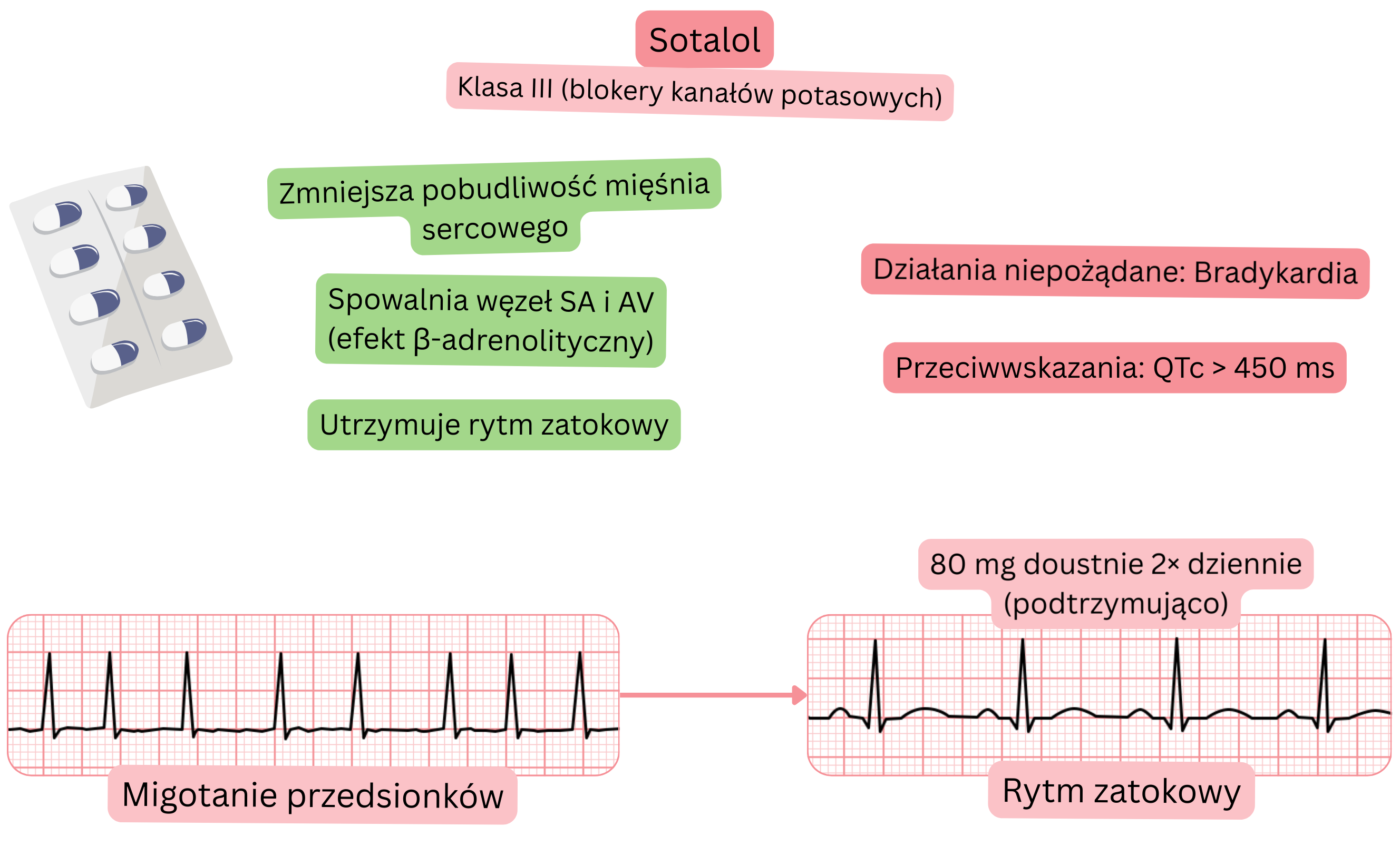 Schemat działania sotalolu jako leku antyarytmicznego klasy III, przedstawiający blokadę kanałów potasowych ze spowolnieniem węzła zatokowego i przedsionkowo-komorowego, zmniejszenie pobudliwości mięśnia sercowego oraz utrzymanie rytmu zatokowego w migotaniu przedsionków.