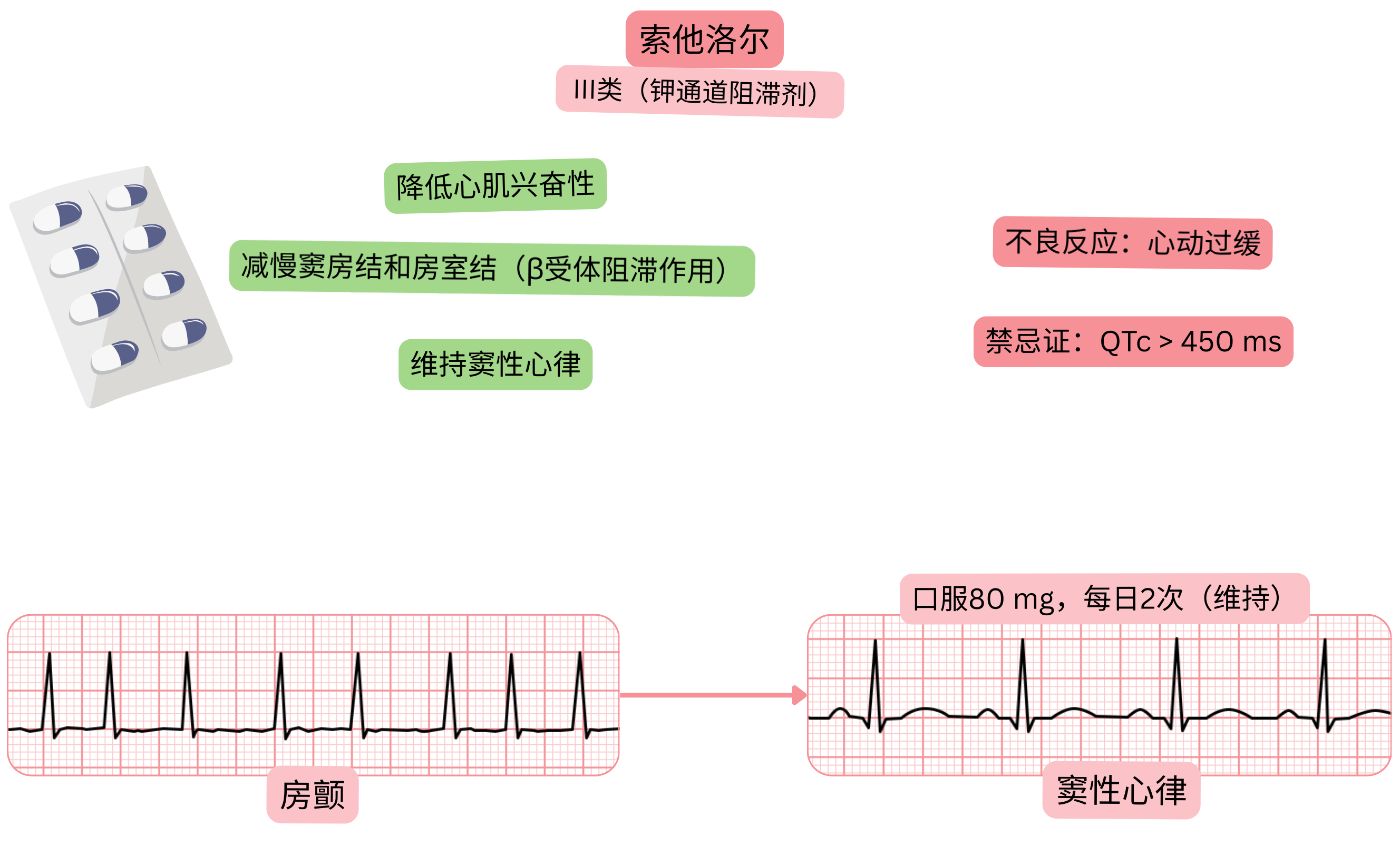 索他洛尔作为III类抗心律失常药物的作用示意图，显示钾通道阻滞，导致窦房结和房室结传导减慢、心肌兴奋性降低，并用于维持心房颤动患者的窦性心律。
