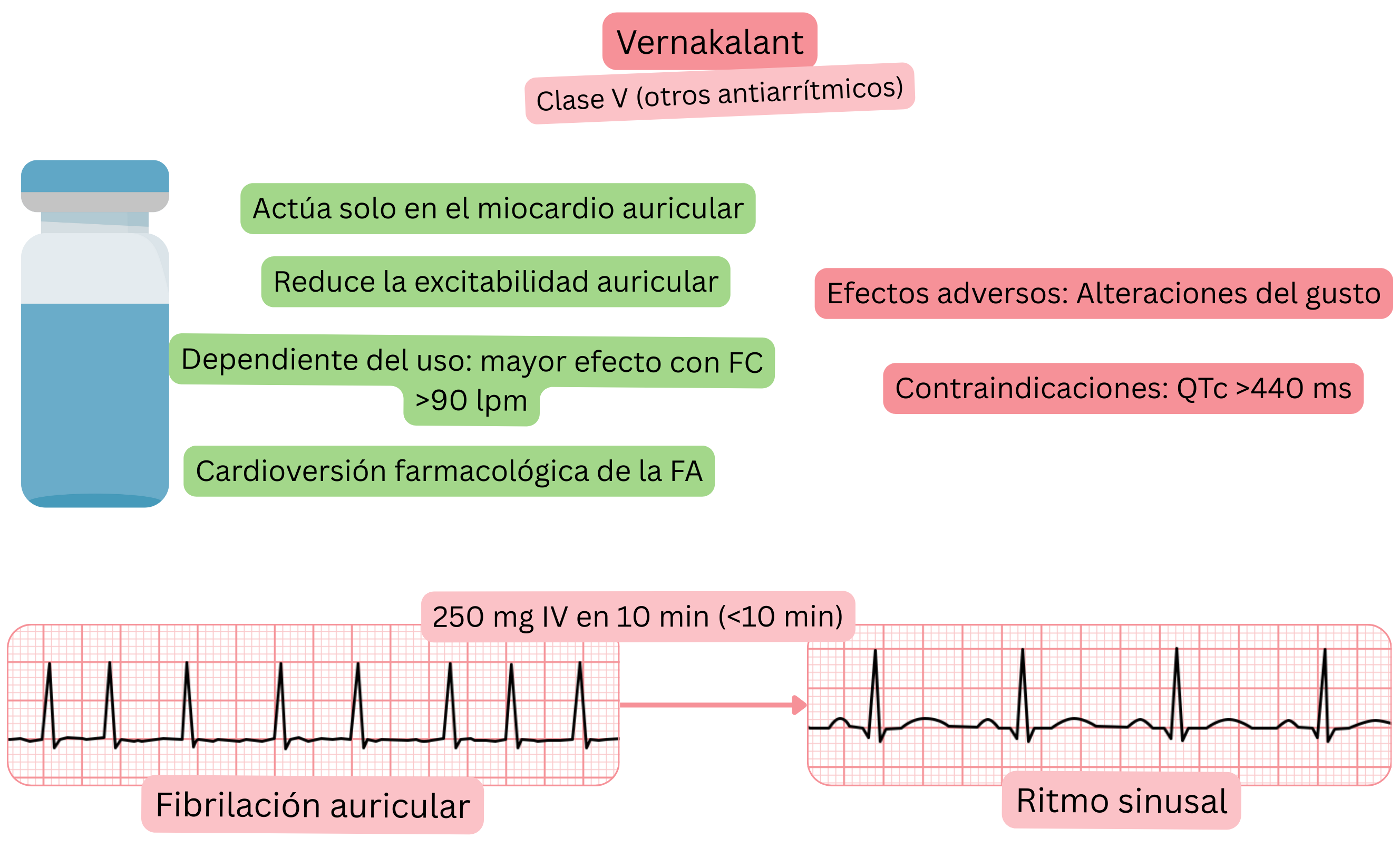 Esquema del efecto del vernakalant como antiarrítmico de clase V que muestra su acción selectiva sobre el miocardio auricular, la reducción de la excitabilidad auricular y la cardioversión farmacológica de la fibrilación auricular a ritmo sinusal.
