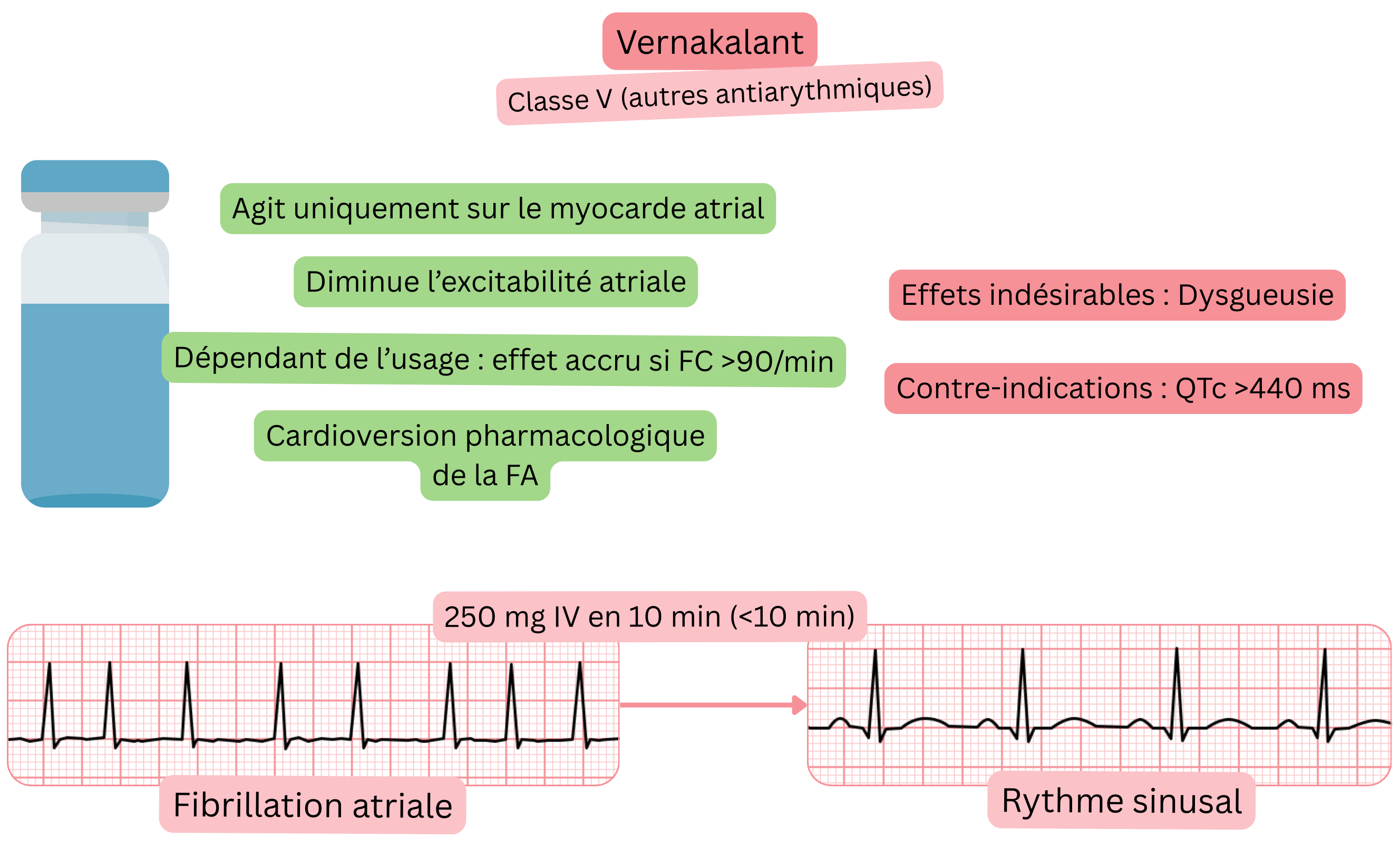 Schéma de l’effet du vernakalant comme antiarythmique de classe V illustrant son action sélective sur le myocarde auriculaire, la diminution de l’excitabilité auriculaire et la cardioversion pharmacologique de la fibrillation auriculaire en rythme sinusal.