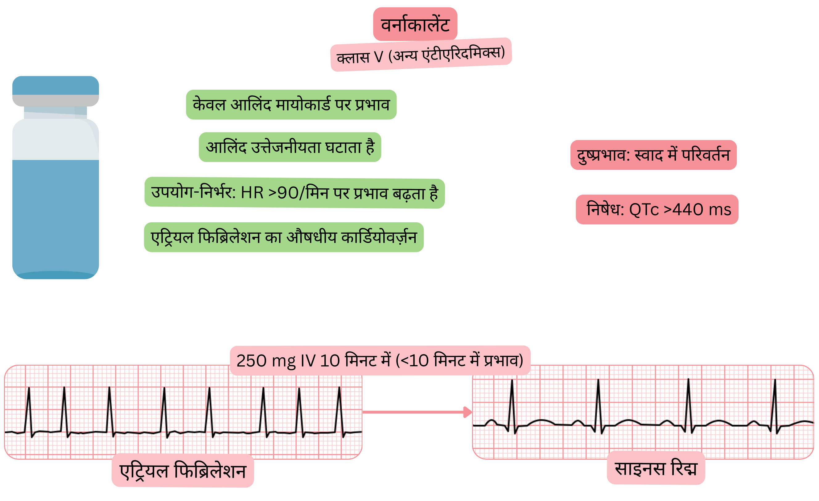 क्लास V एंटीएरिदमिक के रूप में वर्नाकालेंट के प्रभाव का आरेख, जिसमें एट्रियल मायोकार्डियम पर चयनात्मक प्रभाव, एट्रियल उत्तेजनीयता में कमी और एट्रियल फिब्रिलेशन की औषधीय कार्डियोवर्ज़न द्वारा साइनस रिद्म की पुनर्स्थापना दर्शाई गई है।