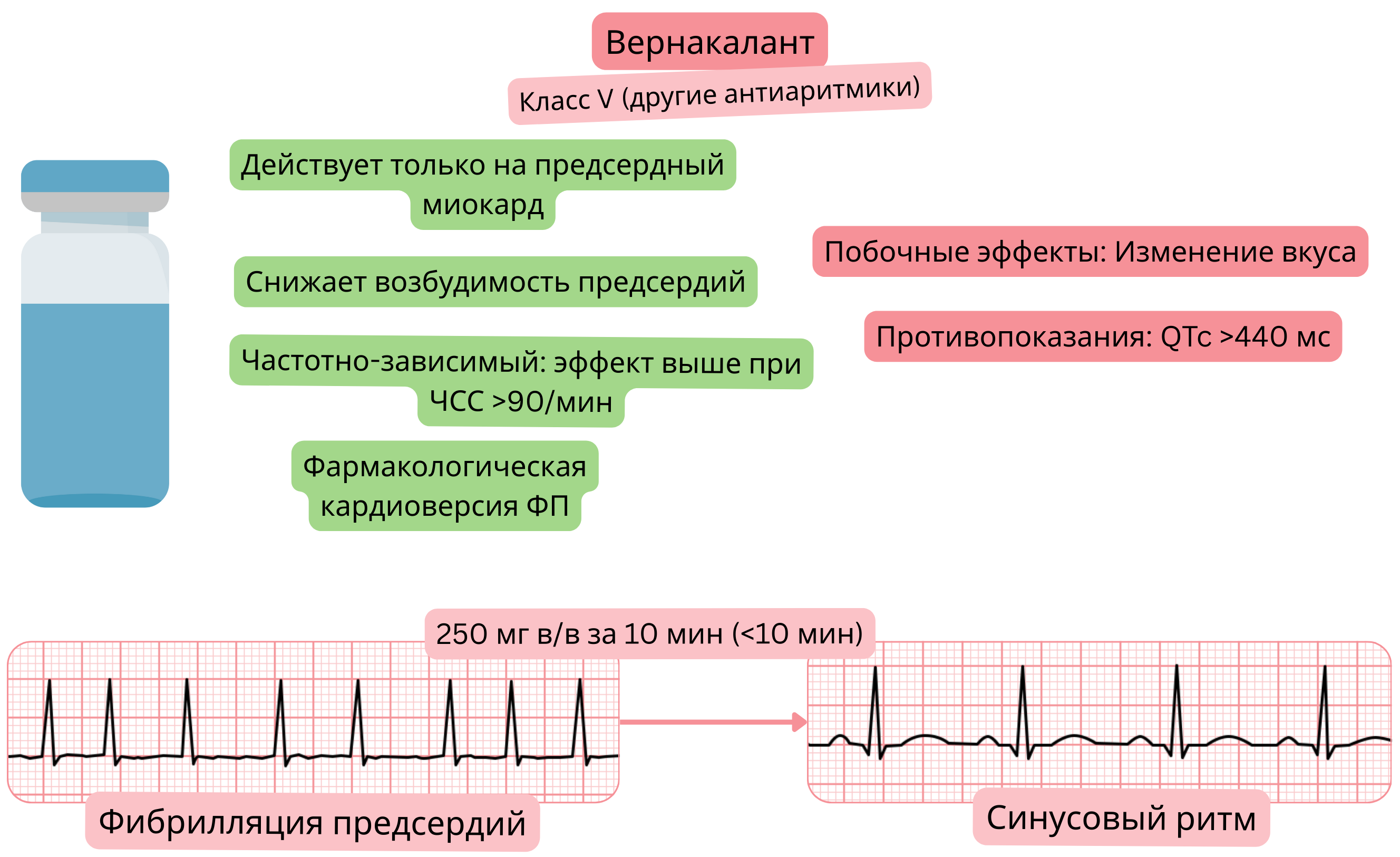 Схема действия вернакаланта как антиаритмического препарата класса V, демонстрирующая селективное воздействие на миокард предсердий, снижение возбудимости предсердий и фармакологическую кардиоверсию фибрилляции предсердий в синусовый ритм.