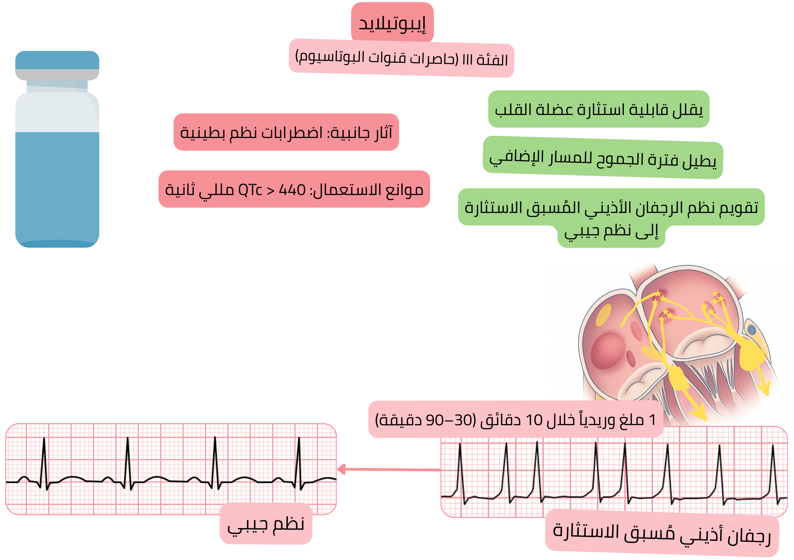 مخطط تأثير الإيبوتيلايد كمضاد اضطراب نظم من الفئة III يوضح إطالة الفترة المقاومة الفعالة للمسار الإضافي والتقويم القلبي الدوائي للرجفان الأذيني المُسبق الإثارة إلى النظم الجيبي.