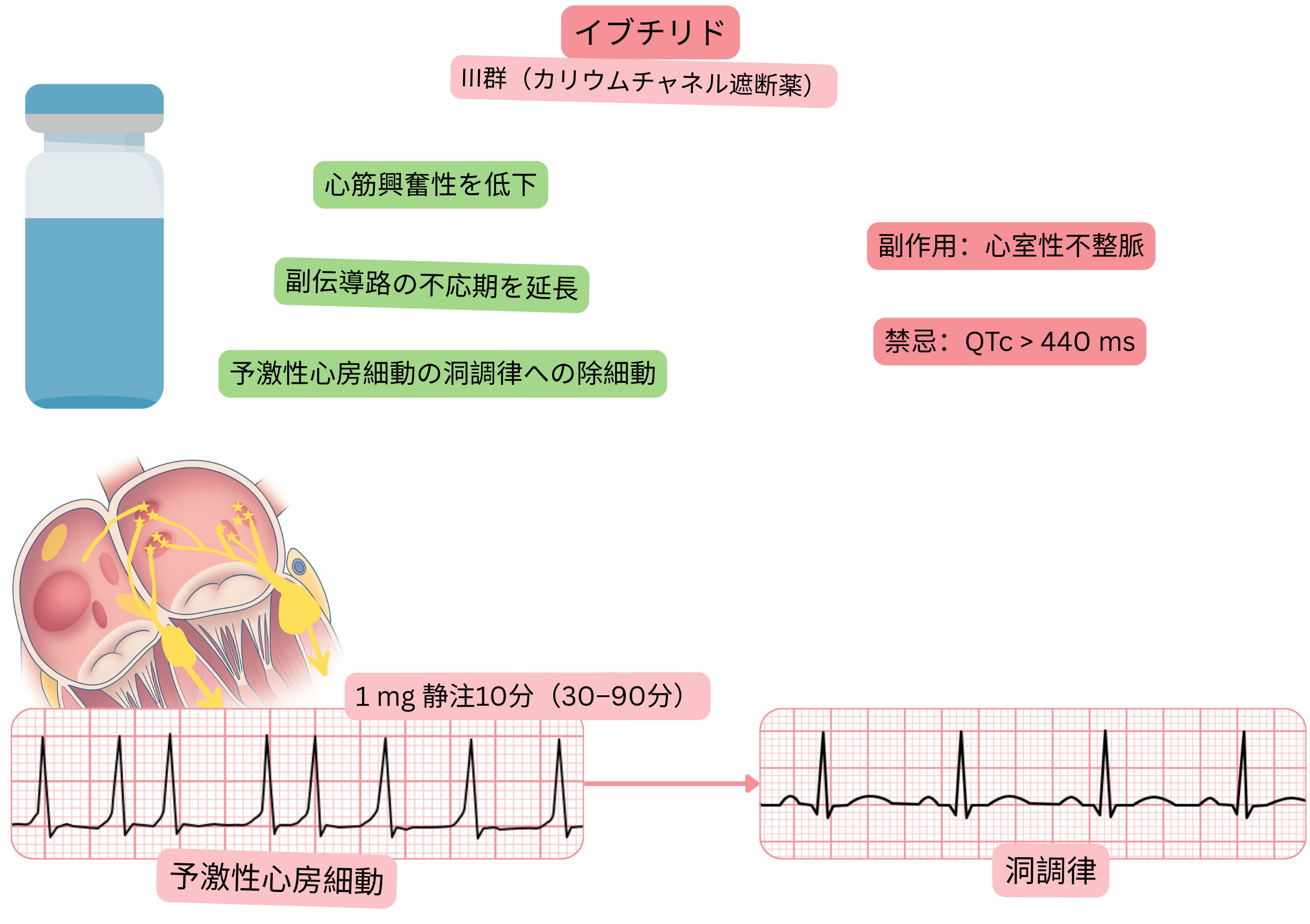 III群抗不整脈薬としてのイブチリドの作用を示す模式図で、副伝導路の有効不応期延長と、前興奮性心房細動の薬物的洞調律化を示す。