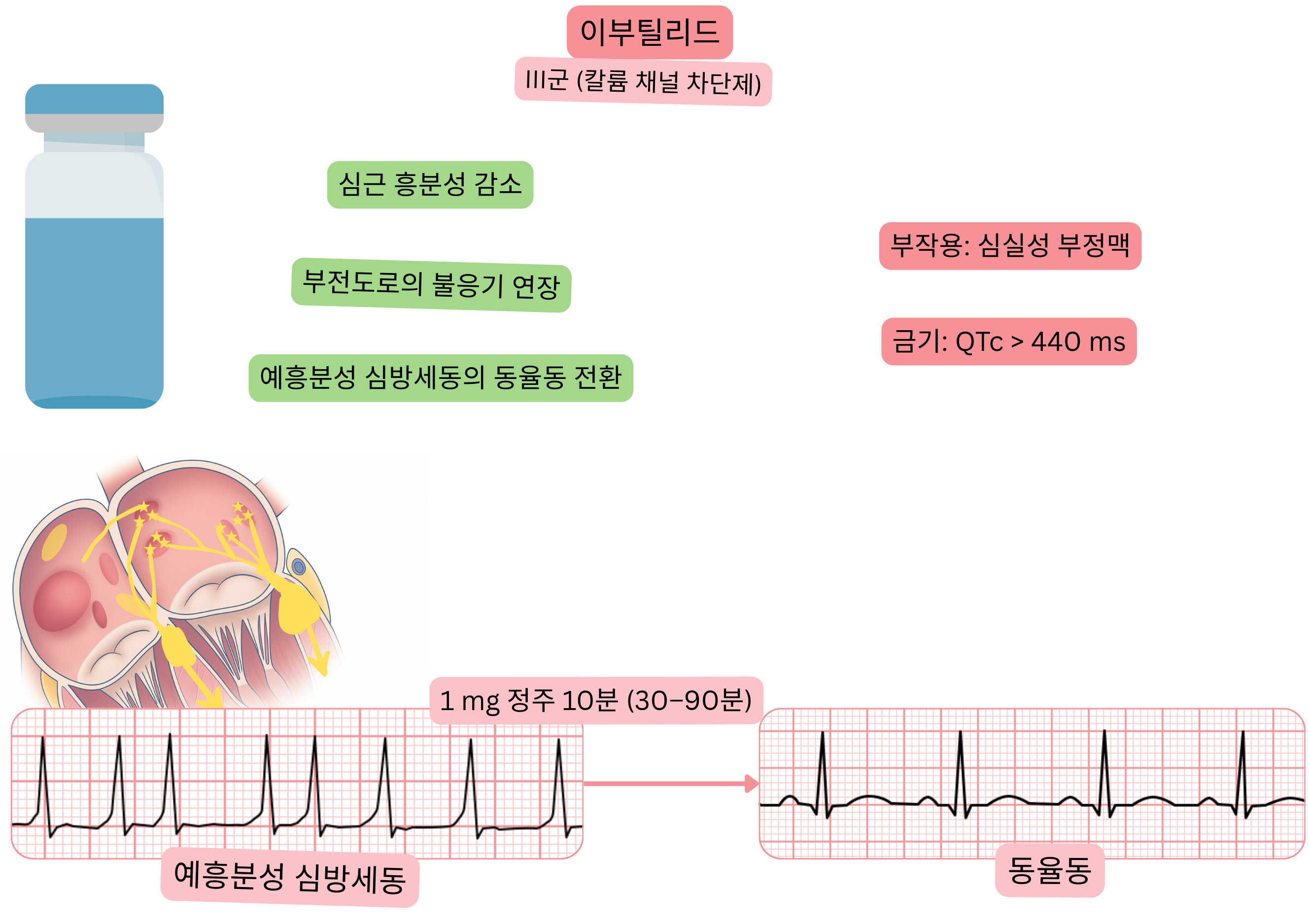 III군 항부정맥제로서 이부틸라이드의 효과를 나타낸 도식으로, 부전도로의 유효 불응기 연장과 전흥분성 심방세동의 약물적 동율동 전환을 보여준다.