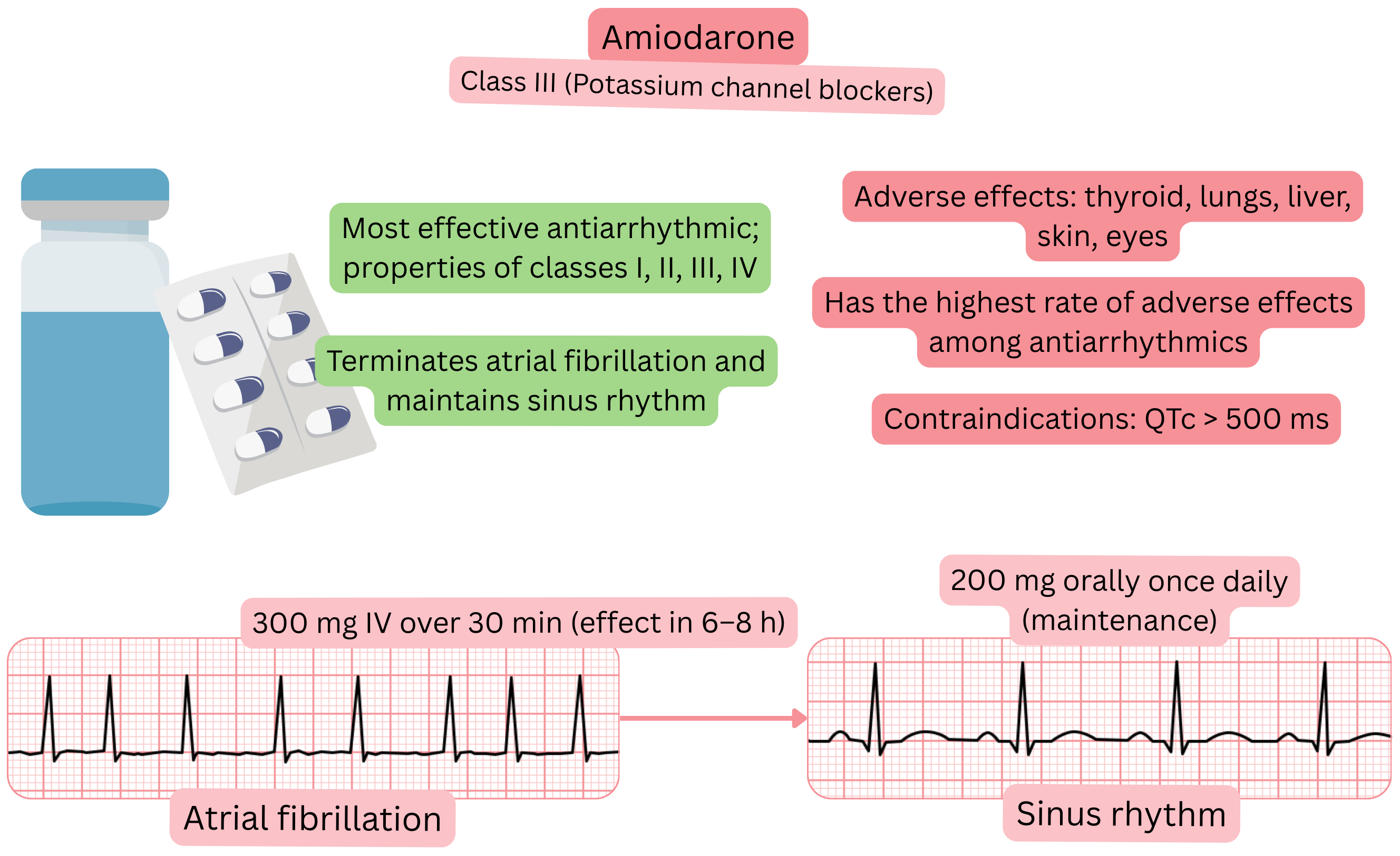 Diagram of the effect of amiodarone as a class III antiarrhythmic with multichannel action illustrating pharmacological cardioversion of atrial fibrillation and maintenance of sinus rhythm.