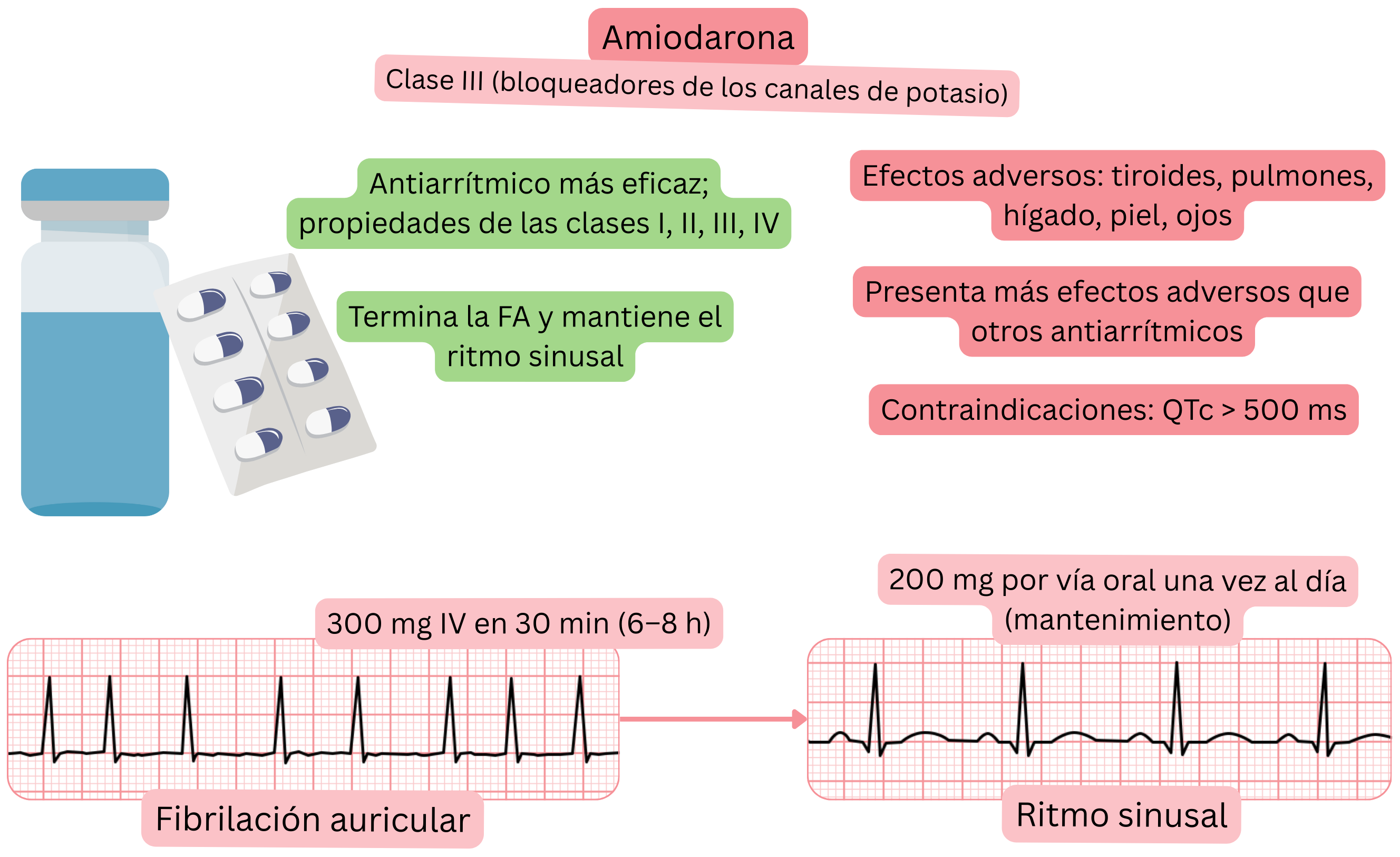 Esquema del efecto de la amiodarona como antiarrítmico de clase III con acción multicanal que muestra la cardioversión farmacológica de la fibrilación auricular y el mantenimiento del ritmo sinusal.