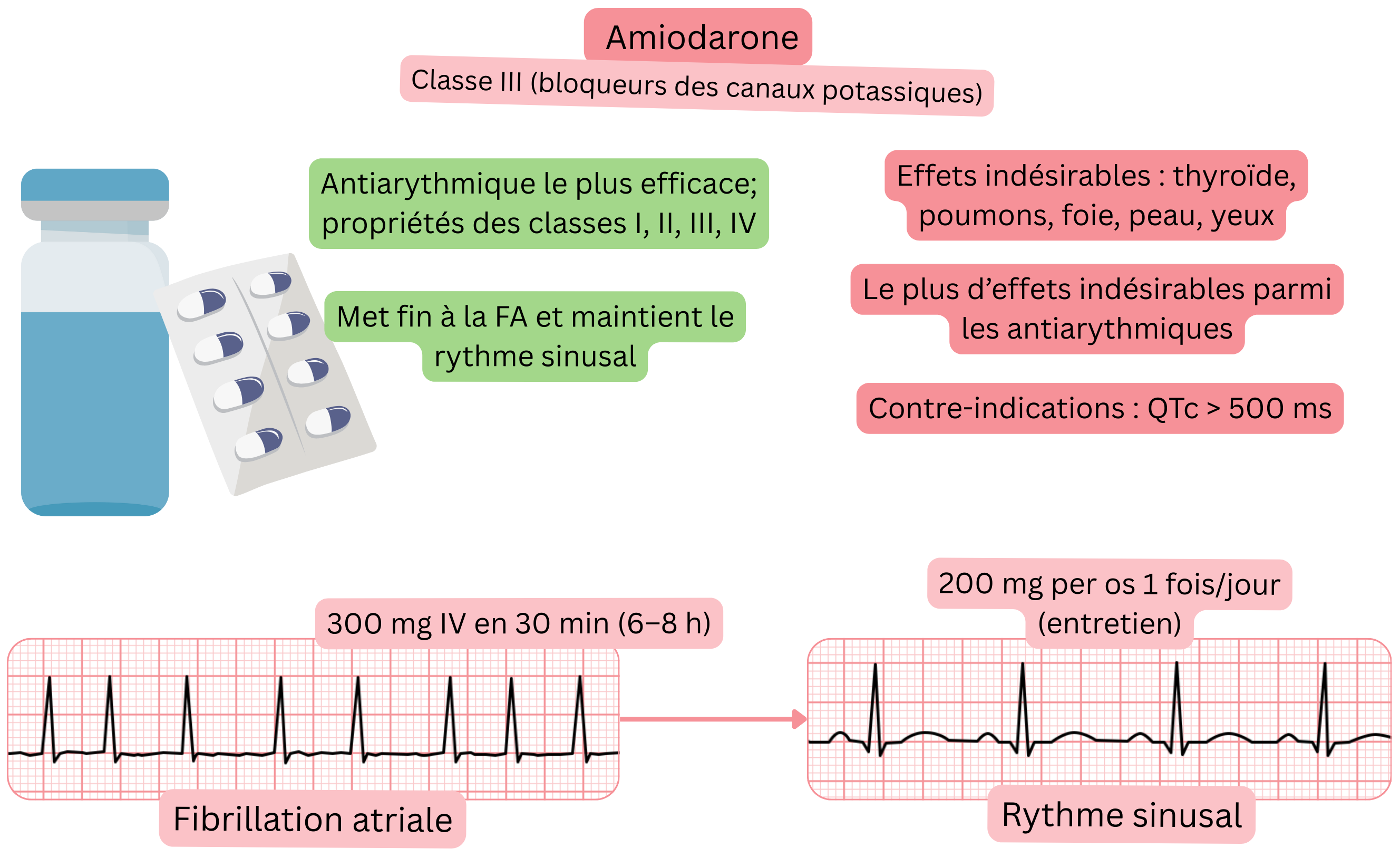 Schéma de l’effet de l’amiodarone comme antiarythmique de classe III à action multicanal illustrant la cardioversion pharmacologique de la fibrillation auriculaire et le maintien du rythme sinusal.